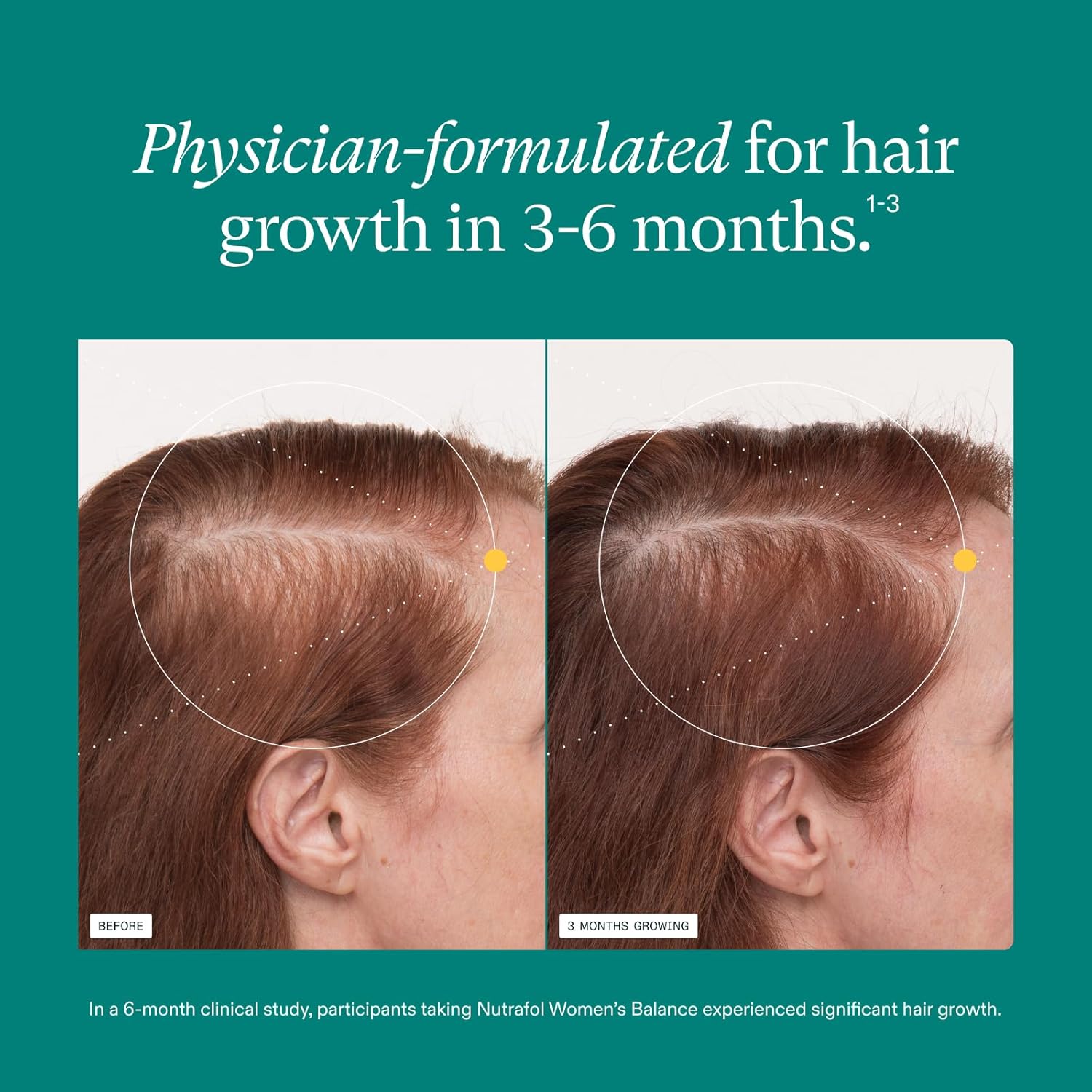Nutrafol Women's Balance Hair Growth Supplements, Dermatologist Recommended, Ages 45 and Up, Clinically Proven for Visibly Thicker Hair and Scalp Coverage - 2 Month Supply, Pack of 2 - Image 4