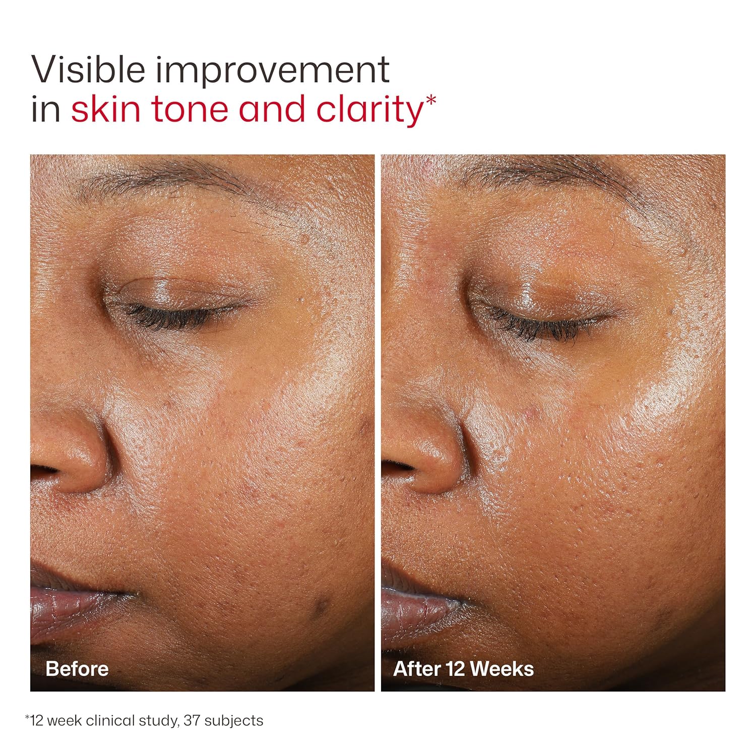 EltaMD UV Clear Face Sunscreen, Oil Free Sunscreen for Sensitive Skin with Zinc Oxide, Dermatologist Recommended - Image 8