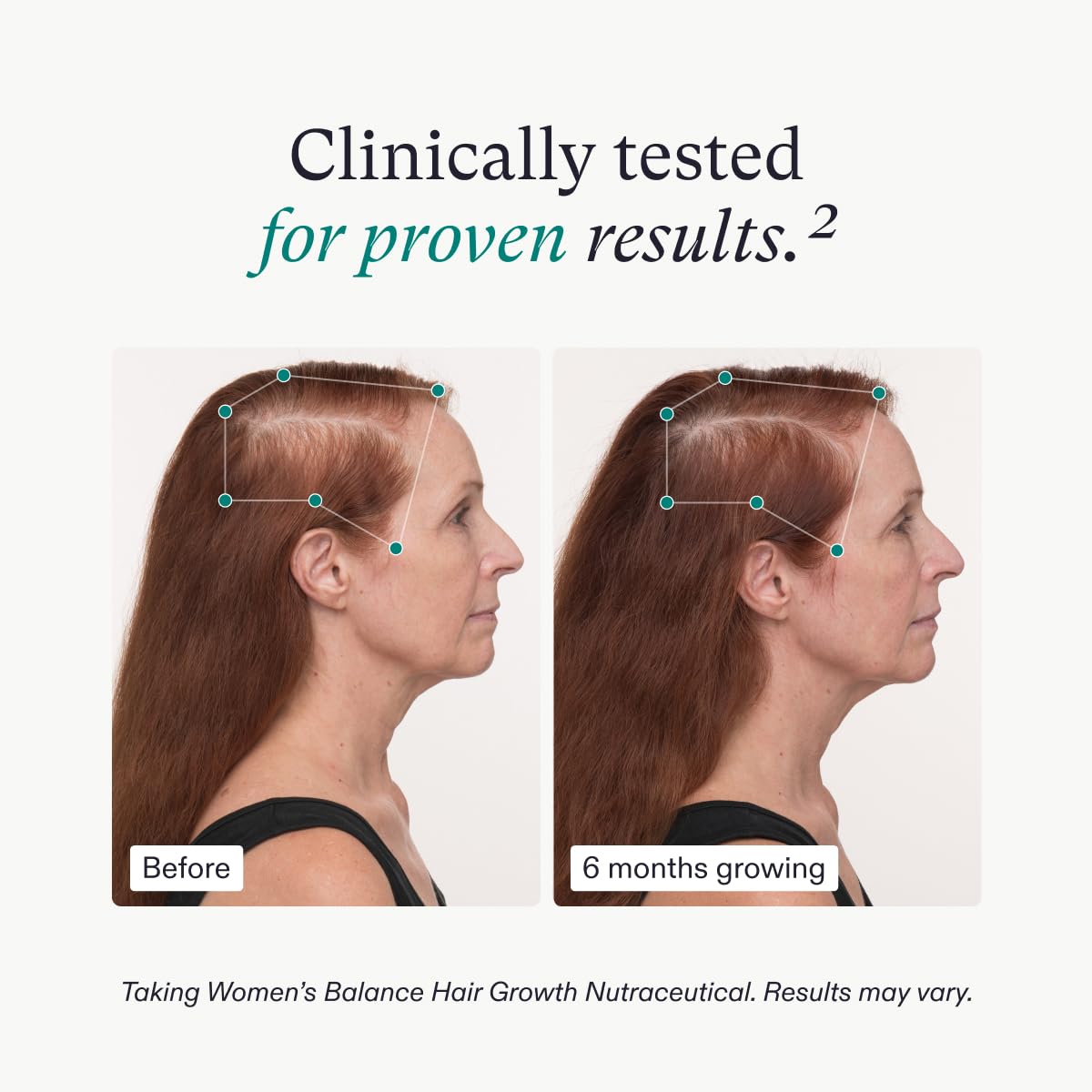 Nutrafol Women's Balance Hair Growth Supplement and Hair Serum, Ages 45 and Up, Clinically Tested for Visible Thickness and Strength - 1 Month Supply, 1.7 Fl Oz Bottle - Image 4