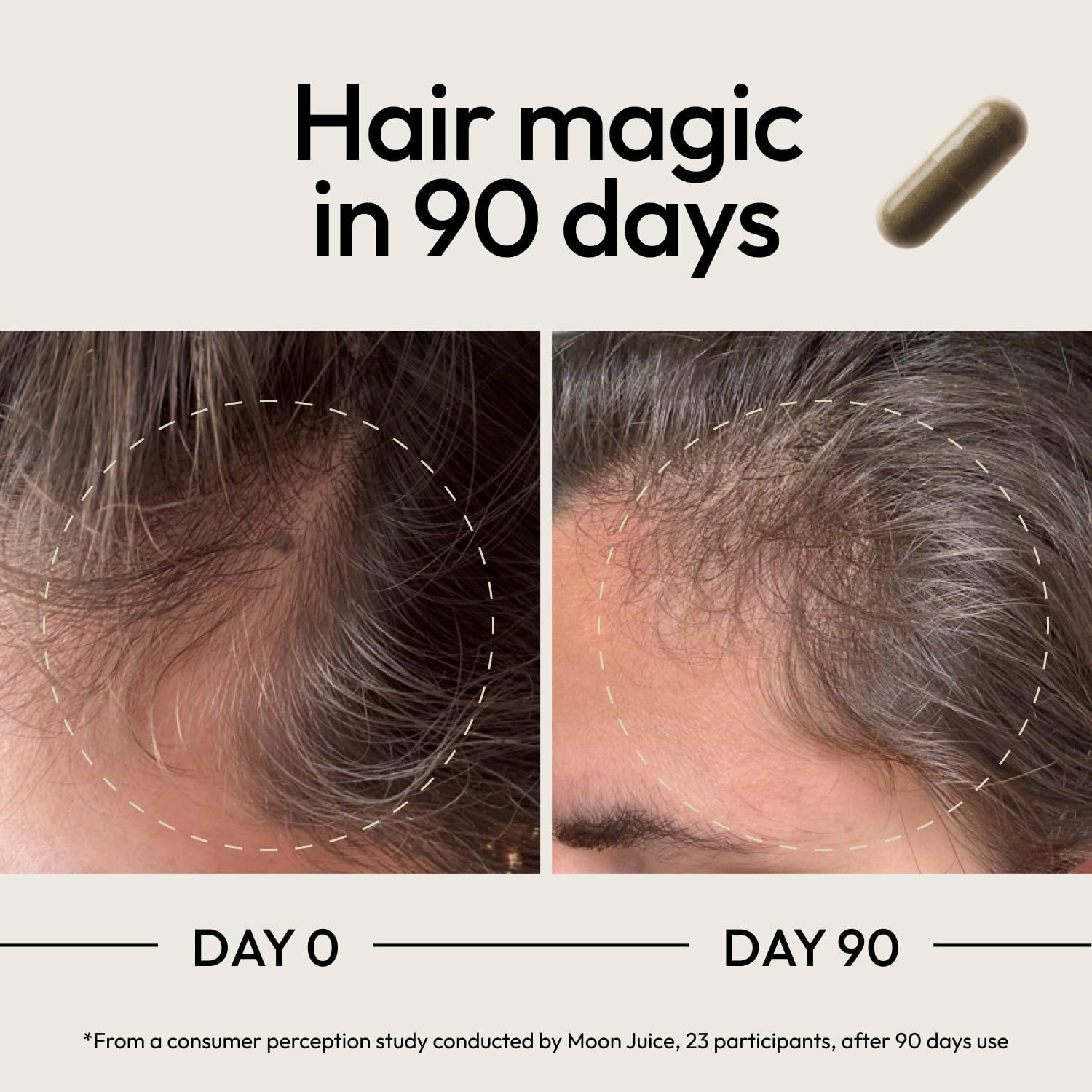 Moon Juice SuperHair Hair Growth Vitamins for Women & Men with Biotin & Saw Palmetto - Clinical Strength Multivitamin Hair Supplement for Healthier, Stronger, Thicker Hair, 120 Capsules - 30 Servings - Image 4