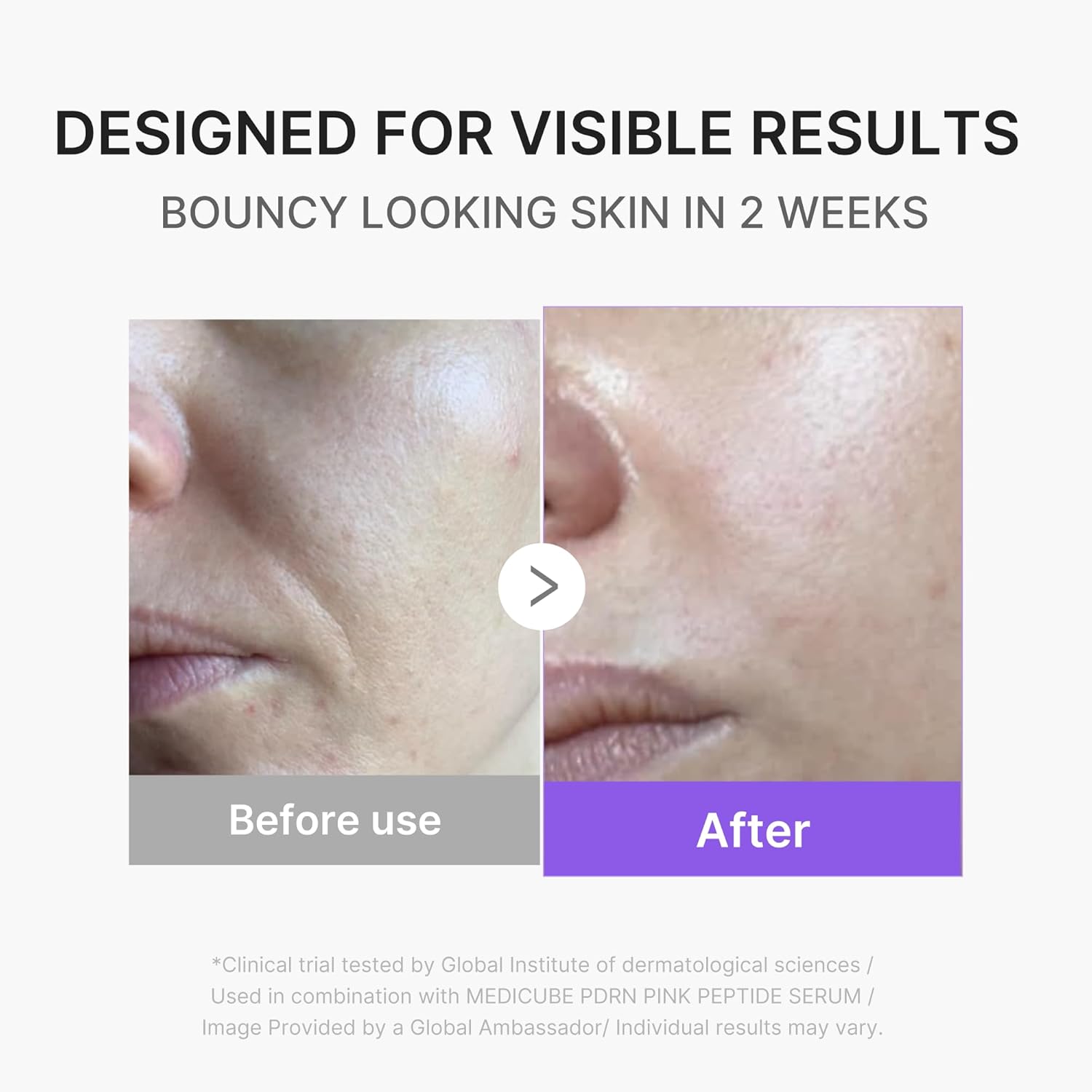 medicube Plumping Booster Device Duo | 3-Mode Facial Device for Radiant, Calming, and Bouncy-Looking Skin | Long-Lasting Hydration with Hyaluronic Acid, Ceramides & Multi Peptides, Beige - Image 6