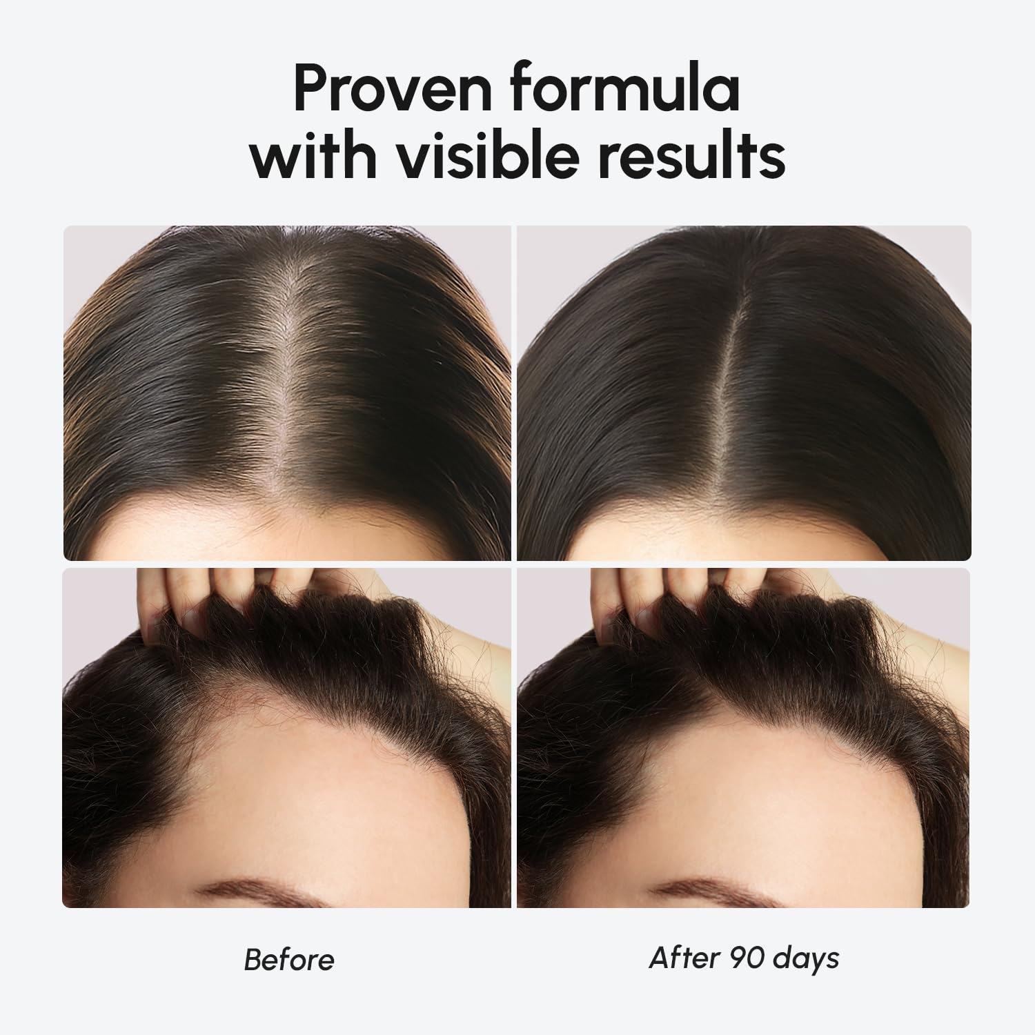 MAREE Hair Growth Serum - Caffeine Peptides Castor Rosemary Oil for Hair Growth - Products for Women & Men - Hair Oils for Hair Growth - Hair Regrowth Tonic - Scalp Serum - Suero Para El Cabello - Image 5