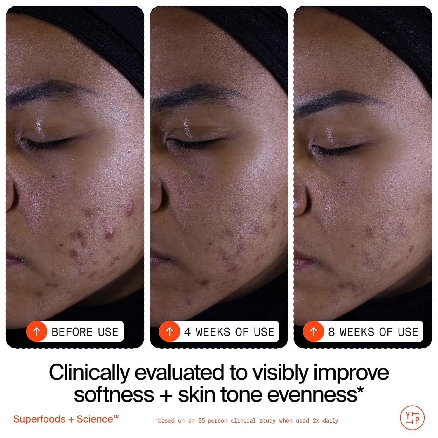 Youth To The People Superfruit Facial Cleanser - Papaya + Vitamin C Gentle Exfoliating Face Wash, Cellular Skin Renewal with AHA + BHA, Evens Skin Tone & Texture for Soft + Radiant Skin, Sulfate-free - Image 6