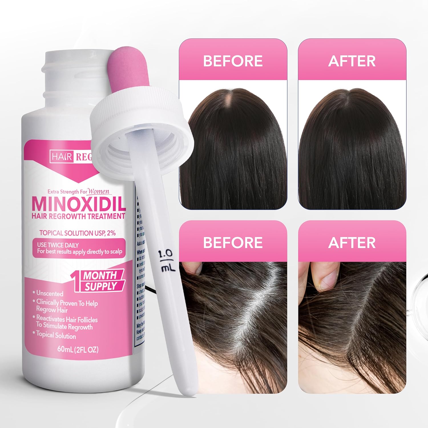 Hair Regen Liquid Minoxidil Women 2% Percent - Extra Strength Advanced Topical Solution for Regrowth Serum Drops - Clinically Proven Growth Treatment for Hers Hair Loss 1 Pack as 1 Month Supply Kit - Image 4