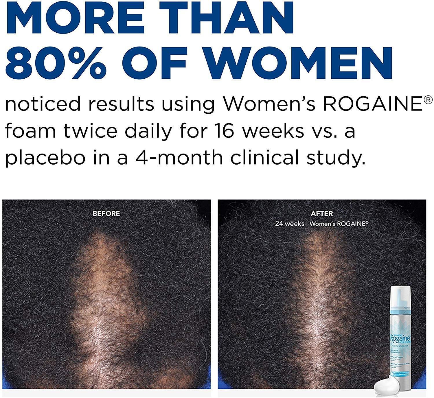 Rogaine 5% Minoxidil Foam, Topical Once-A-Day Hair Loss Treatment for Women to Regrow Fuller, Thicker Hair, Unscented, 2-Month Supply, 2.11 oz - Image 5