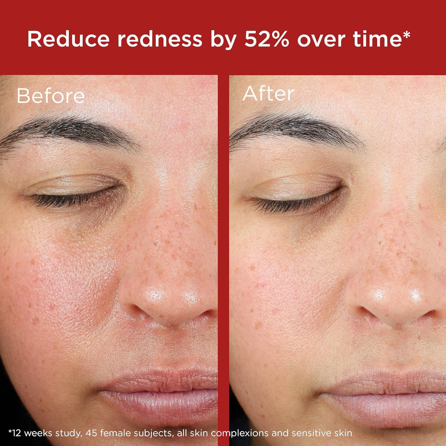 EltaMD UV Skin Recovery Face Sunscreen with Zinc Oxide, All Mineral, Safe for Sensitive Skin SPF 50 - Image 4