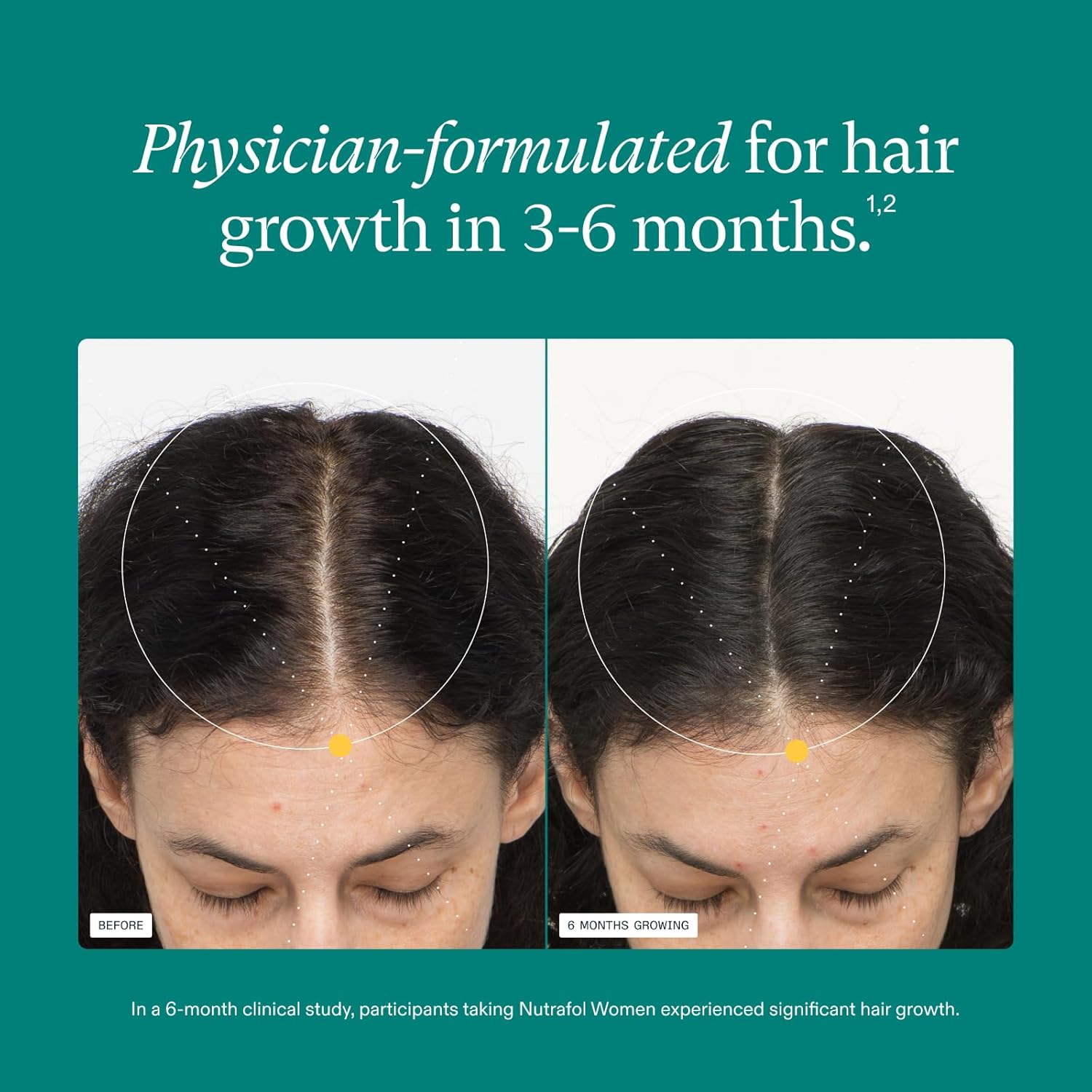 Nutrafol Women's Hair Growth Supplements, Ages 18-44, Clinically Proven for Visibly Thicker and Stronger Hair in 3-6 Months, Dermatologist Recommended - 2 Month Supply, 2 Refill Pouches - Image 4