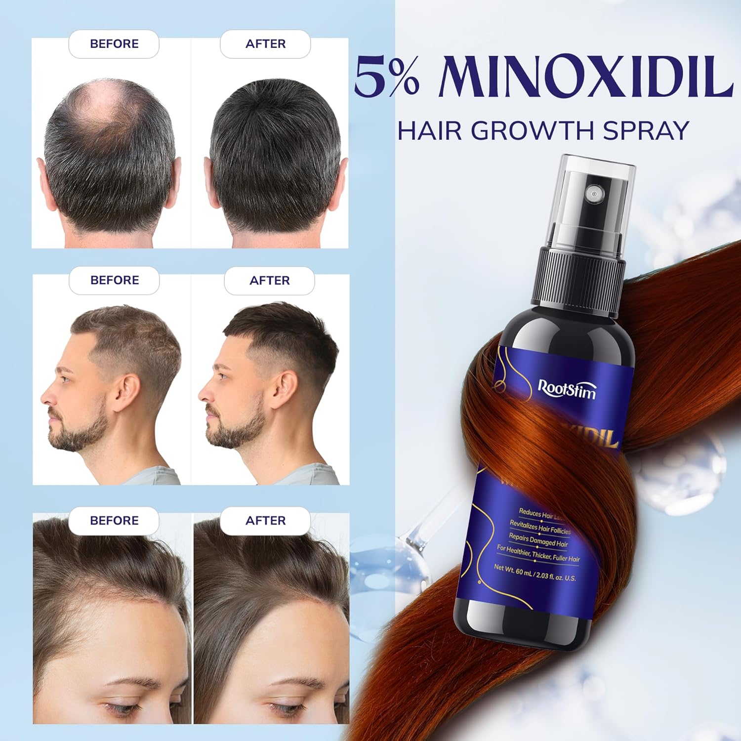 5% Minoxidil Hair Growth for Men and Women: 3-Pack RootStim Extra Strength Minoxidil Beard Regrowth Treatment with Rosemary for Thinning Hair Regrowth and Fuller Hair 180 ML - Image 4