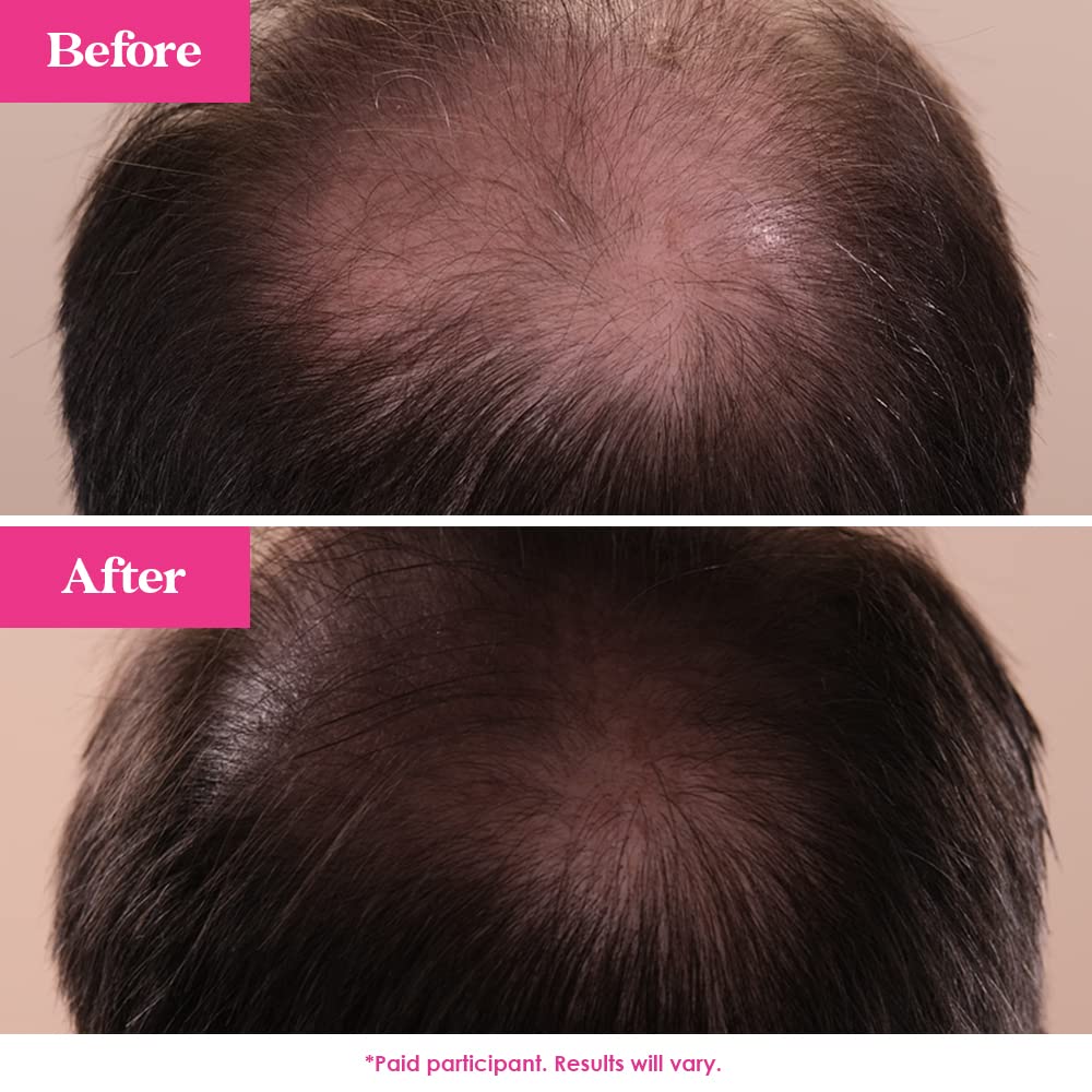 Grande Cosmetics GrandeHAIR Hair Enhancing Serum for Men and Women, Promotes Thickness in Thinning Hair, Safe for Color Treated Hair - Image 6