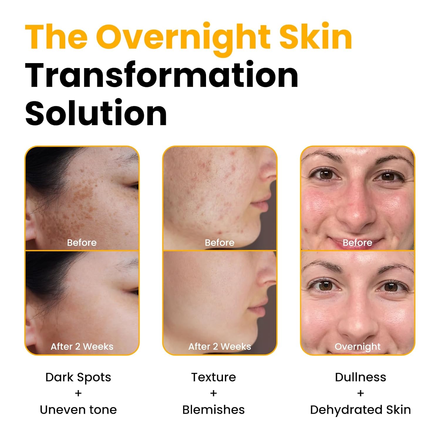 QUIA Turmeric + Kojic Acid Overnight Wrapping Mask – Hydration Mask for Glowing Skin – Evens Tone, Soothes Redness and Improves Skin Texture – Korean Skincare 75ML - Image 3