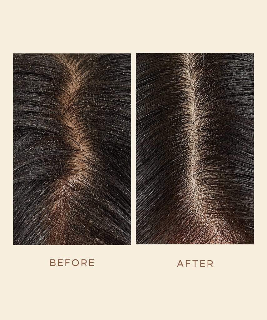 VEGAMOUR GRO Scalp Detoxifying Serum, Scalp Serum with Zinc PCA Removes Buildup & Soothes Scalp, Natural Citrus Scent, 2 fl. oz. - Image 6
