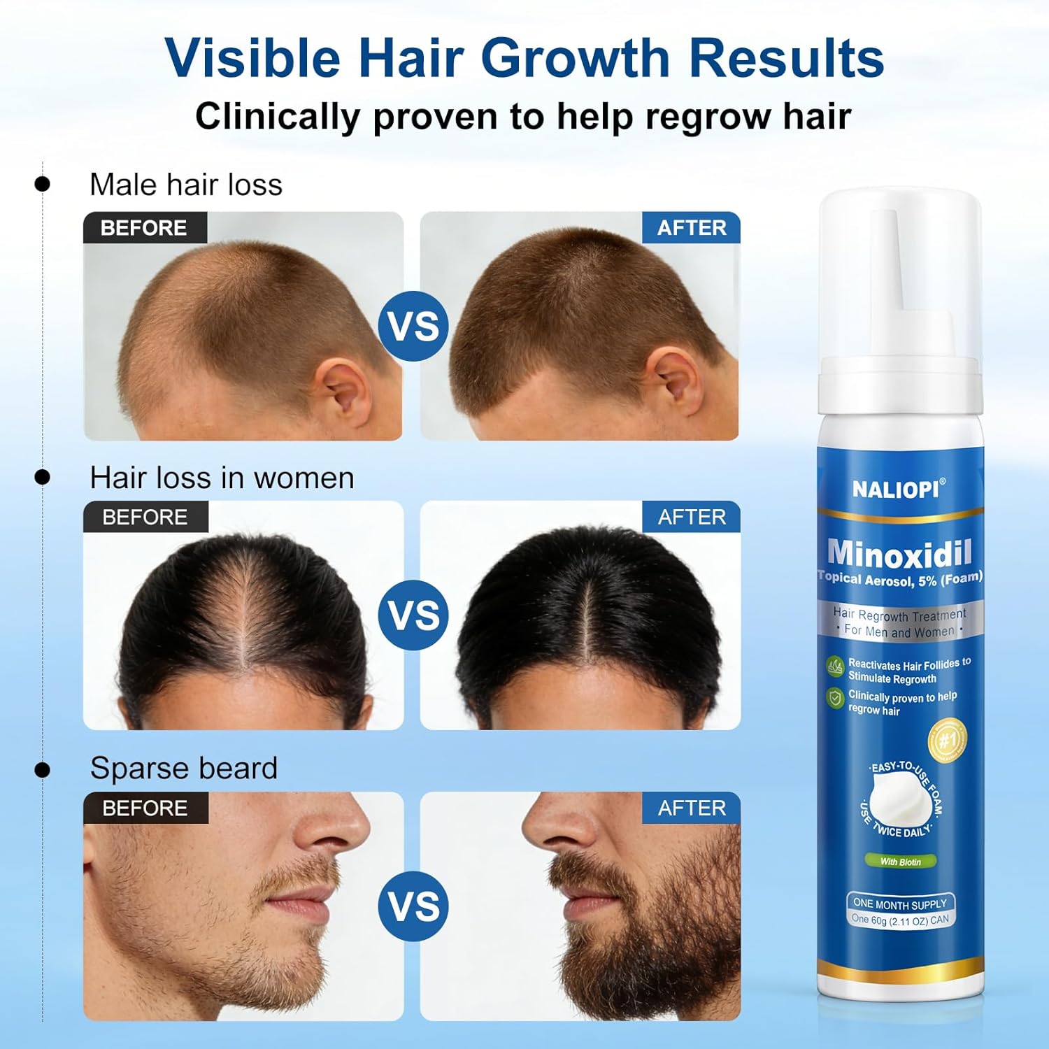 8 Pack 5% Minoxidil Foam for Men & Women, Hair Regrowth Treatment, Extra Strength, Biotin-Infused, Unscented, 8 Bottles (60ml Each), 8-Month Supply, Promotes Thicker & Fuller Hair - Image 4