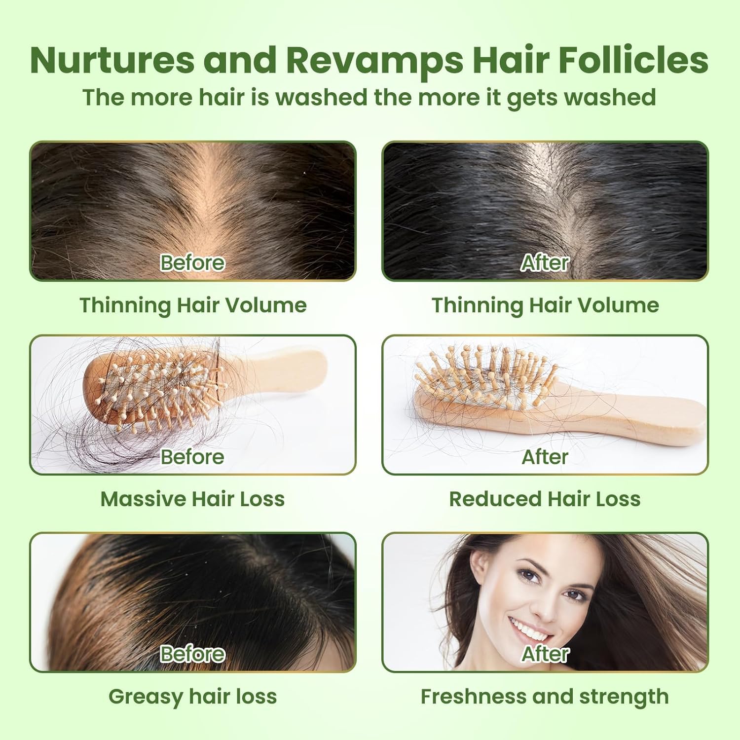 Rosemary Shampoo for Hair Growth: Thickening & Regrowth Formula for Women & Men - Rosemary Mint Strengthening Shampoo with Tea Tree Oil Biotin for Thinning & Loss Hair & Dry Damaged Care - Image 2