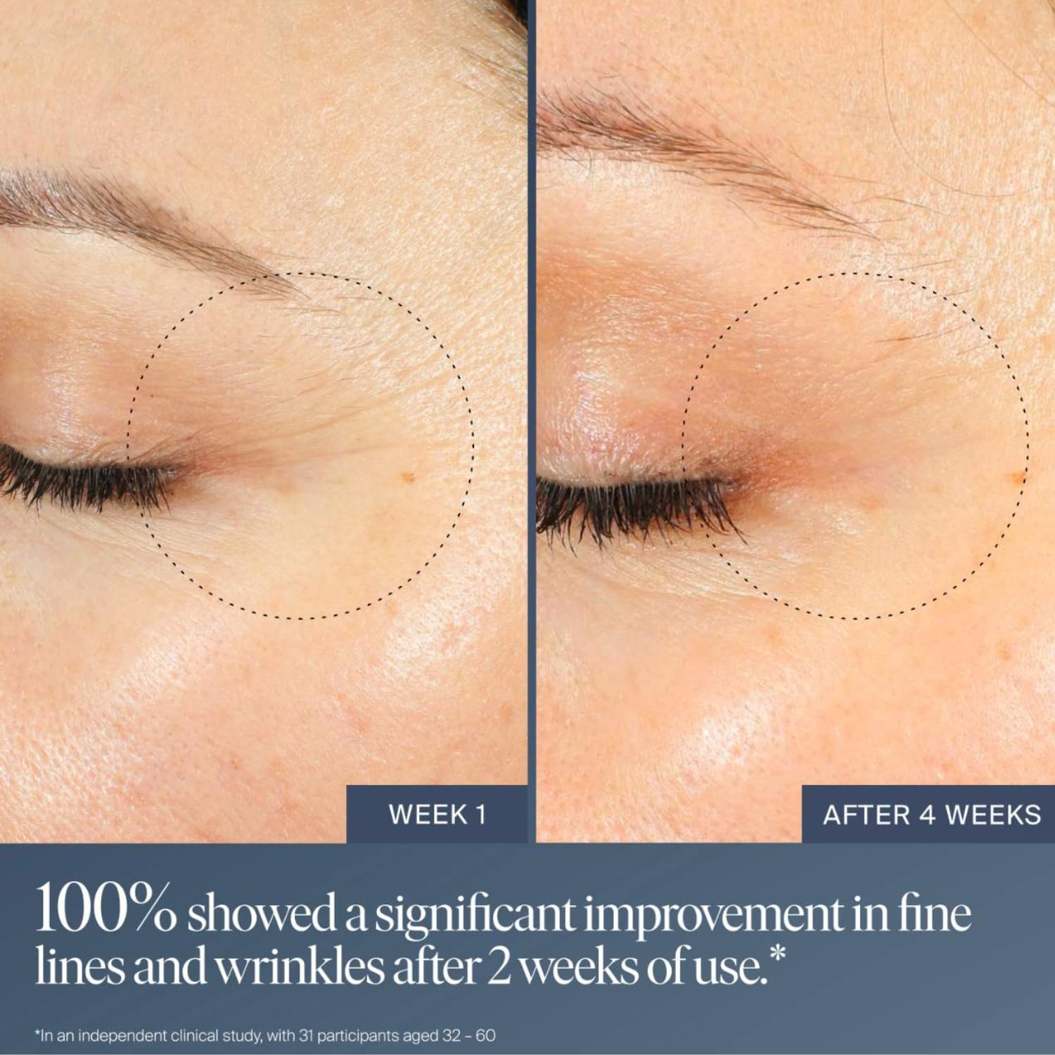 Summer Fridays Jet Lag Overnight Eye Serum - Nourishing Undereye Treatment for Dark Circles - Helps to Hydrate, Smooth, Firm & Depuff - Enriched with Glycerin to Lock in Moisture (0.5 Fl Oz) - Image 3
