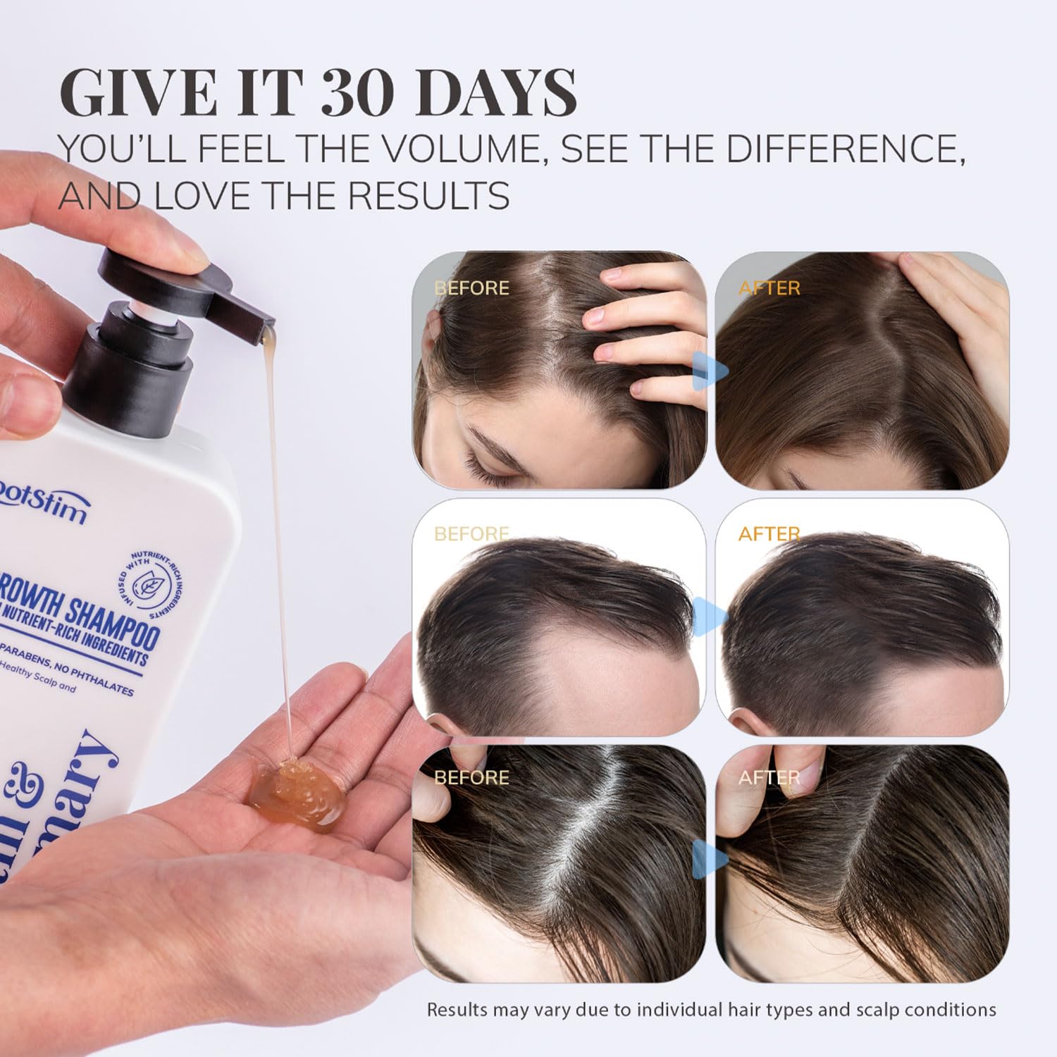 Biotin & Rosemary Shampoo for Hair Growth: Hair Loss Shampoo for Thinning Hair Infused with Natural Nutrient Rich Ingredients for Hair thickening Sulfate Free 10 fl oz - Image 5