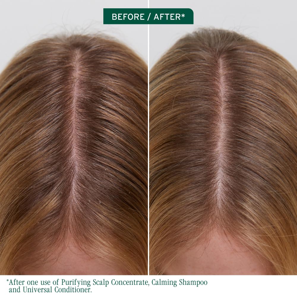 Biolage Scalp Sync Purifying Concentrate - For All Scalp Types, Exfoliating & Clarifying Treatment, Removes Buildup, Refreshing & Reinvigorating, Fermented Tea Blend & Glycolic Acid - Image 2