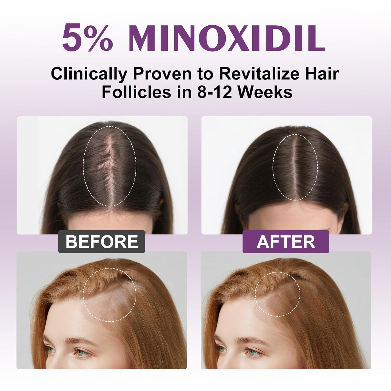 5% Minoxidil Spray for Women-Free minoxidil applicator included,monoxide for men hair Infused with Biotin, hers hair regrowth treatment, Supports Thicker and Fuller Hair & Beard (13oz, 7 Month Supply) - Image 6