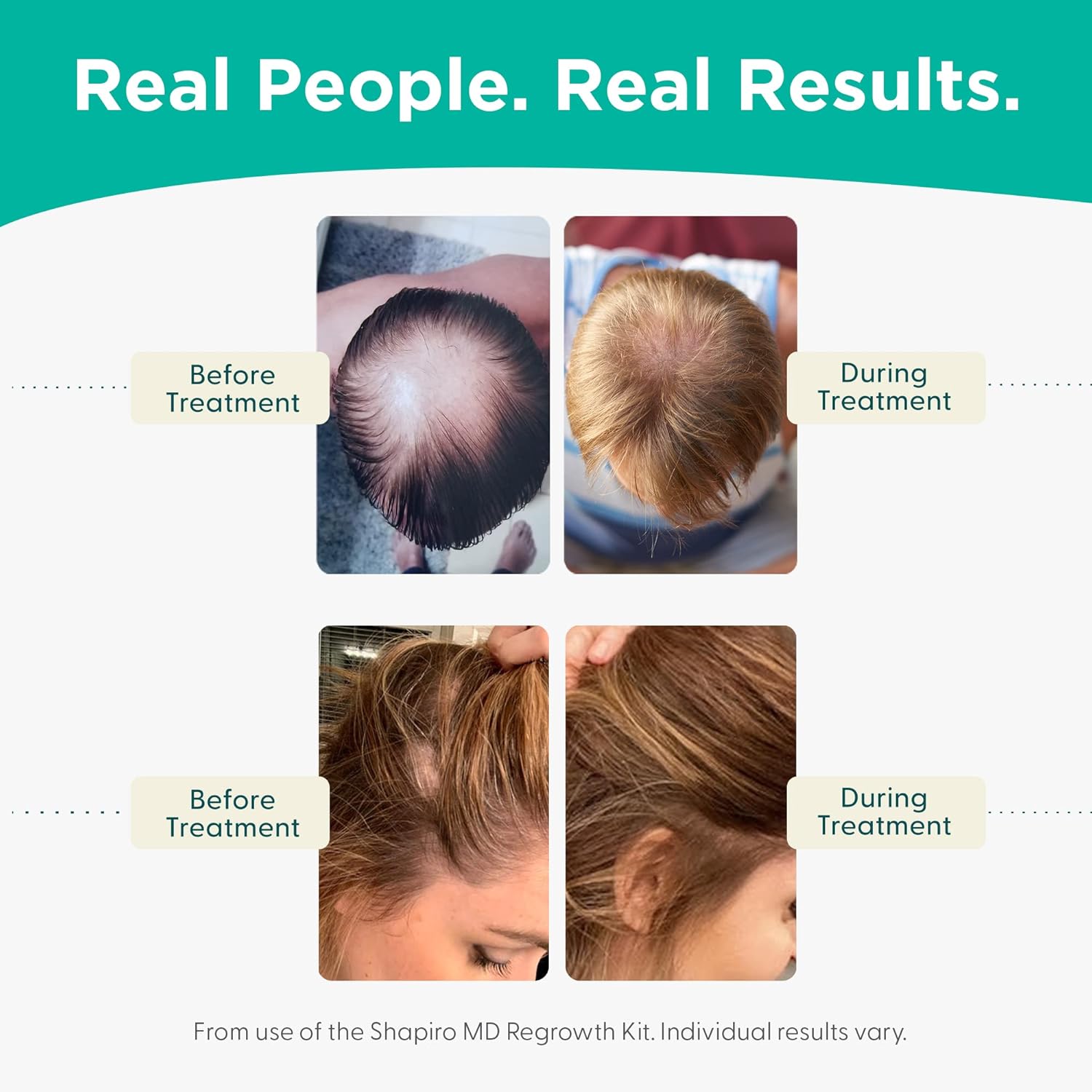 Shapiro MD Hair Growth Experts Hair Loss Shampoo and Conditioner, DHT Fighting Vegan Formula for Thinning Hair Developed by Dermatologists, Experience Healthier, Fuller & Thicker Looking Hair - Image 5