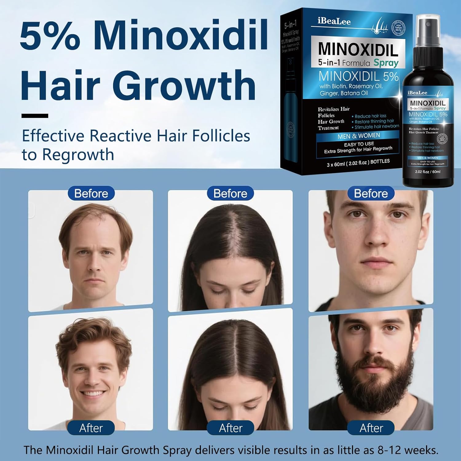 5% Minoxidil for Men and Women Hair Growth, Hair Loss Treatments Serum with Biotin Batana and Rosemary, Minoxidil Hair Growth Spray for Stronger Thicker Fuller Hair Beard Regrowth, 3 Bottles - Image 4