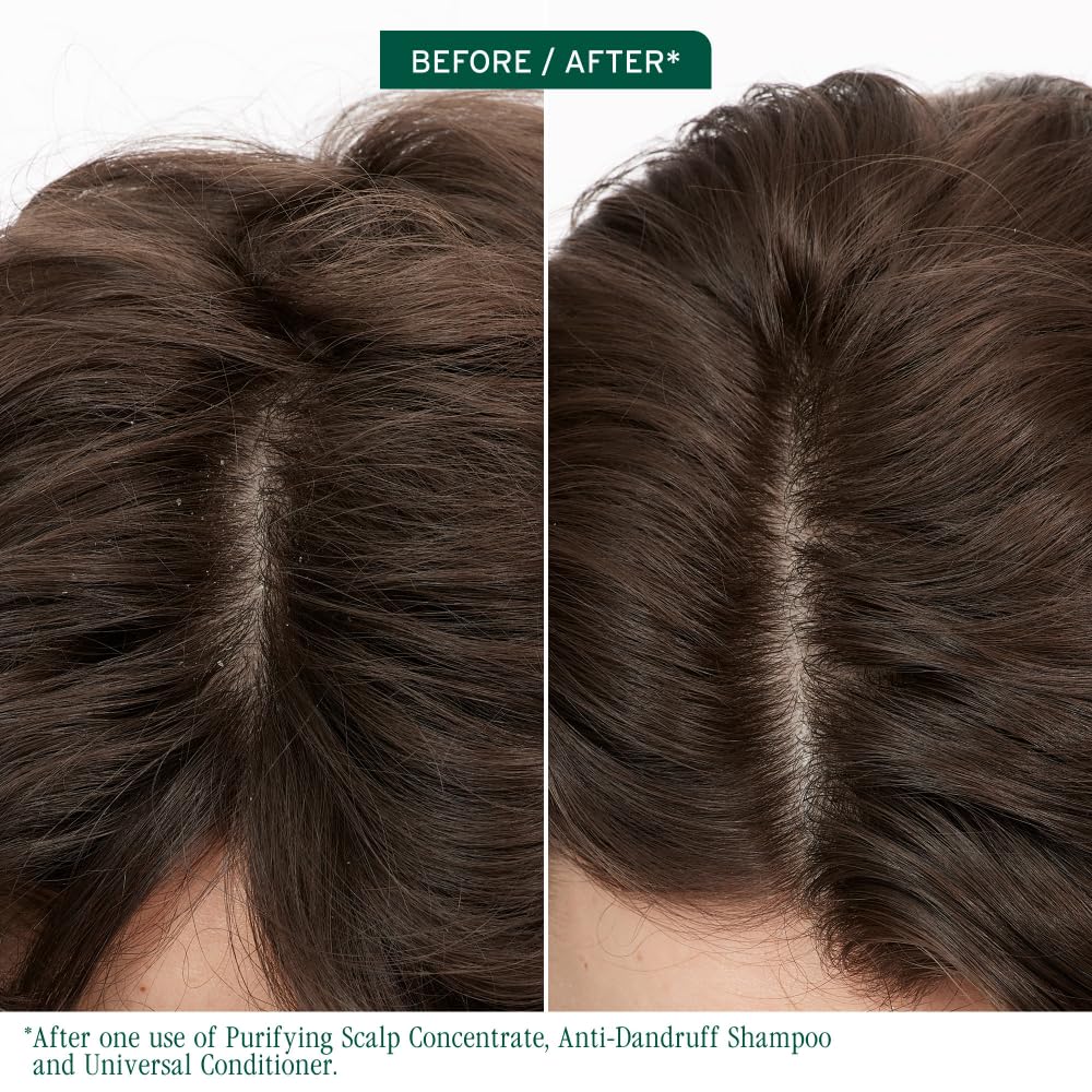 Biolage Scalp Sync Purifying Concentrate - For All Scalp Types, Exfoliating & Clarifying Treatment, Removes Buildup, Refreshing & Reinvigorating, Fermented Tea Blend & Glycolic Acid - Image 3