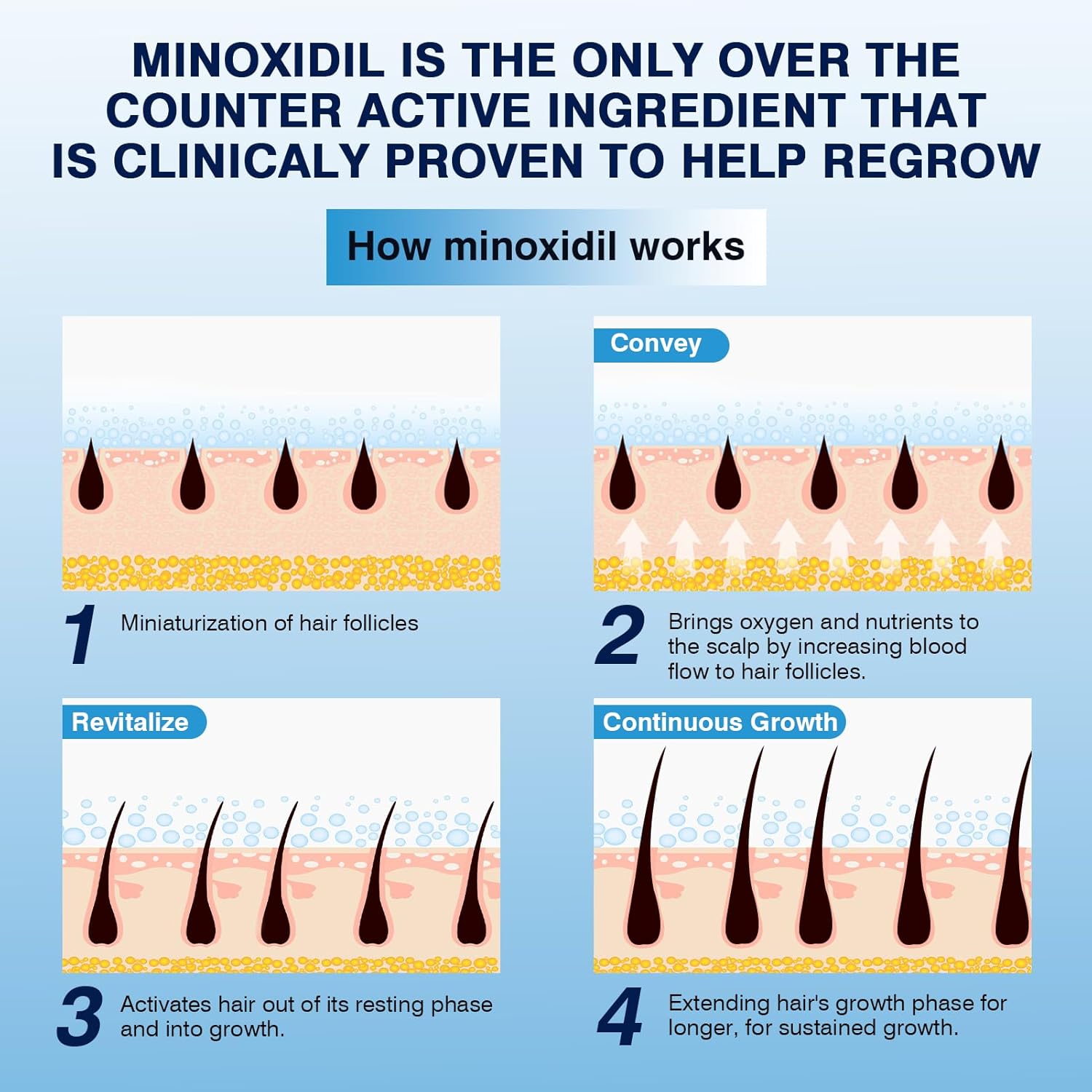 5% Minoxidil Foam– Hair Regrowth Treatment for Men & Women, Prevents Hair Thinning & Strengthens Roots, Minoxidil Foam for Fuller, Healthier Hair,9.52 Ounce (Pack of 1) - Image 5