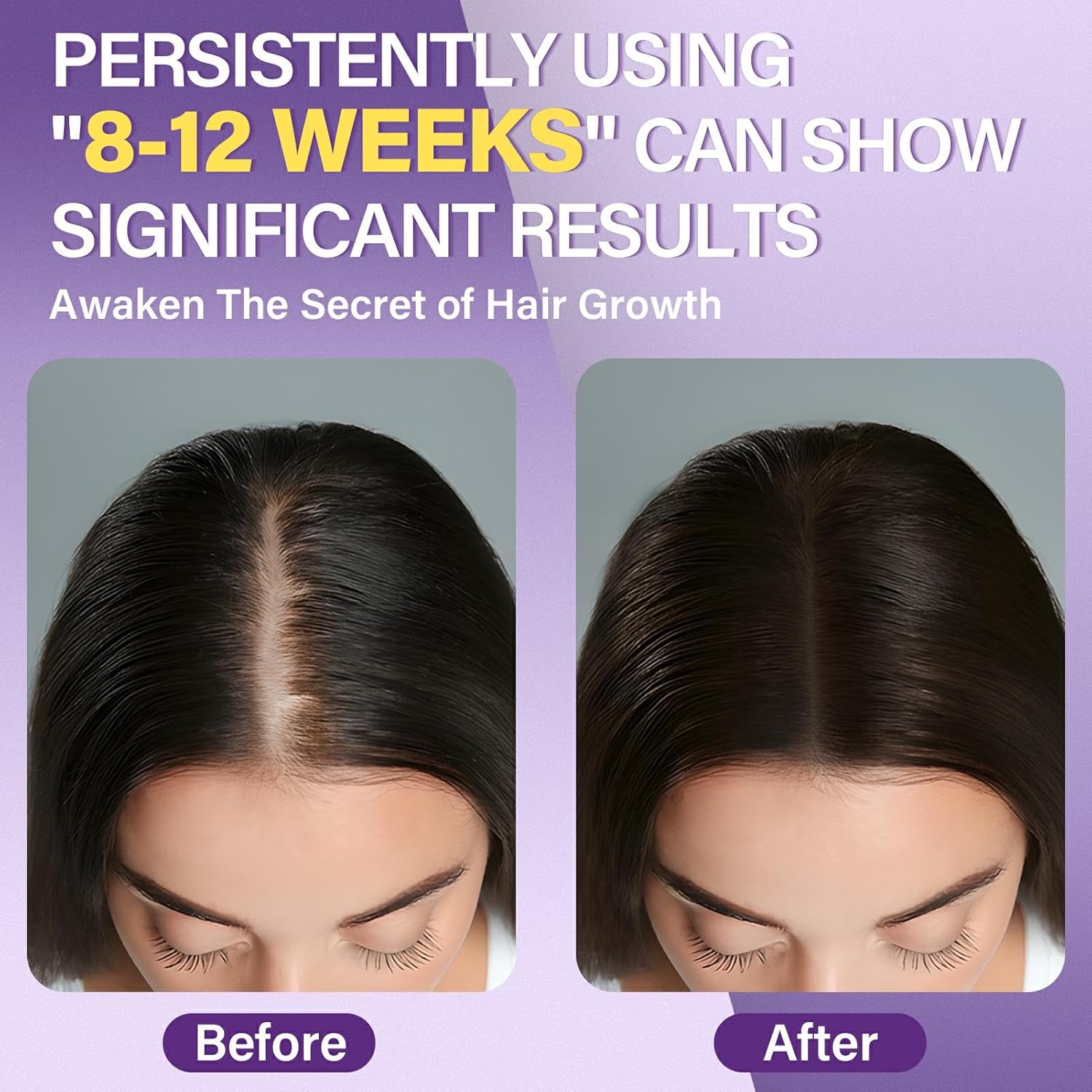 5% Minoxidil Foam for Women - Image 2
