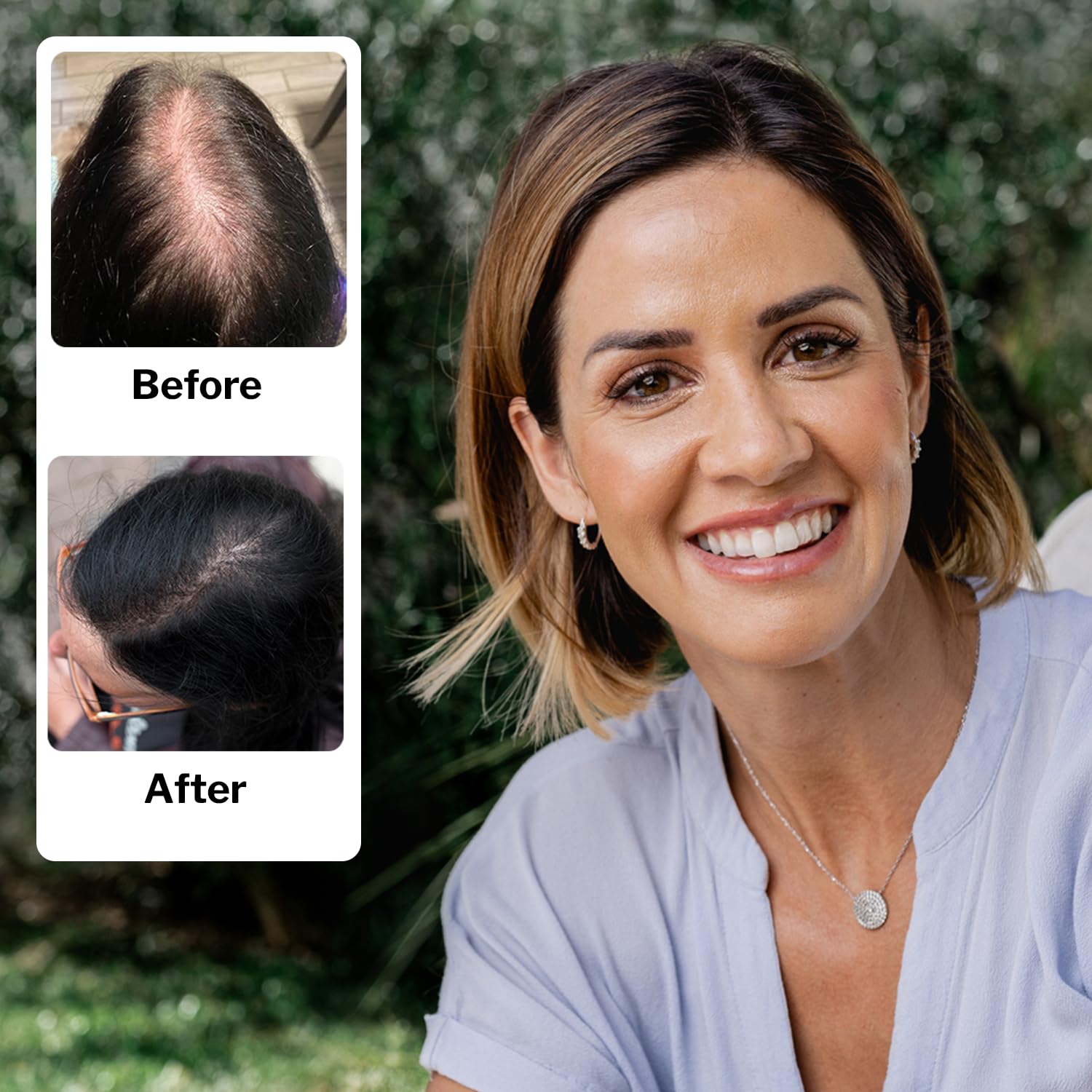 Shapiro MD Hair Growth Experts Women's Regrowth Kit Plus: Shampoo, Conditioner, 2% Minoxidil, Leave-In Foamer. Anti Hair Loss and Thinning Hair Solution for Women, 1 Month - Image 5