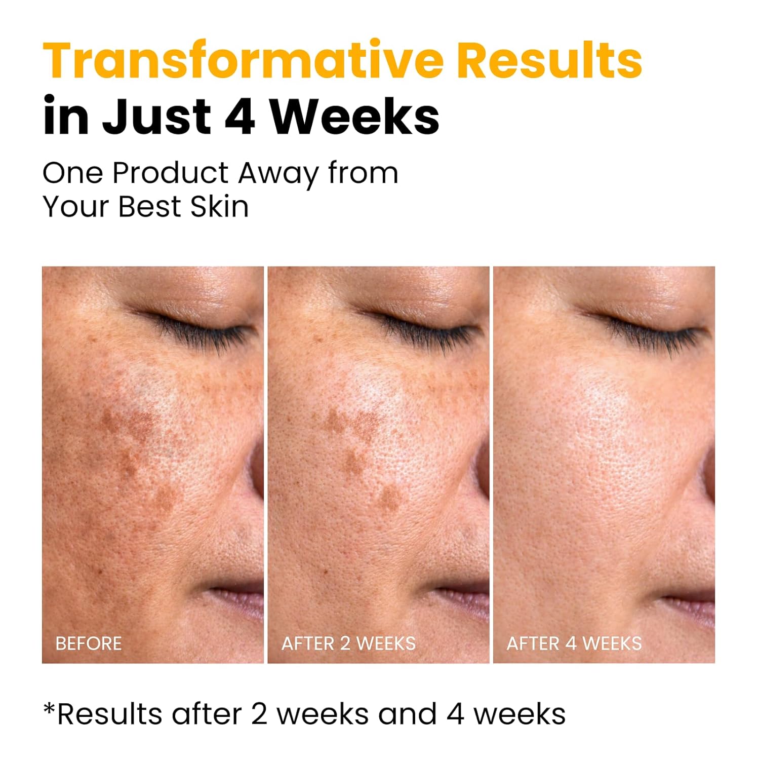 QUIA Turmeric + Kojic Acid Overnight Wrapping Mask – Hydration Mask for Glowing Skin – Evens Tone, Soothes Redness and Improves Skin Texture – Korean Skincare 75ML - Image 5