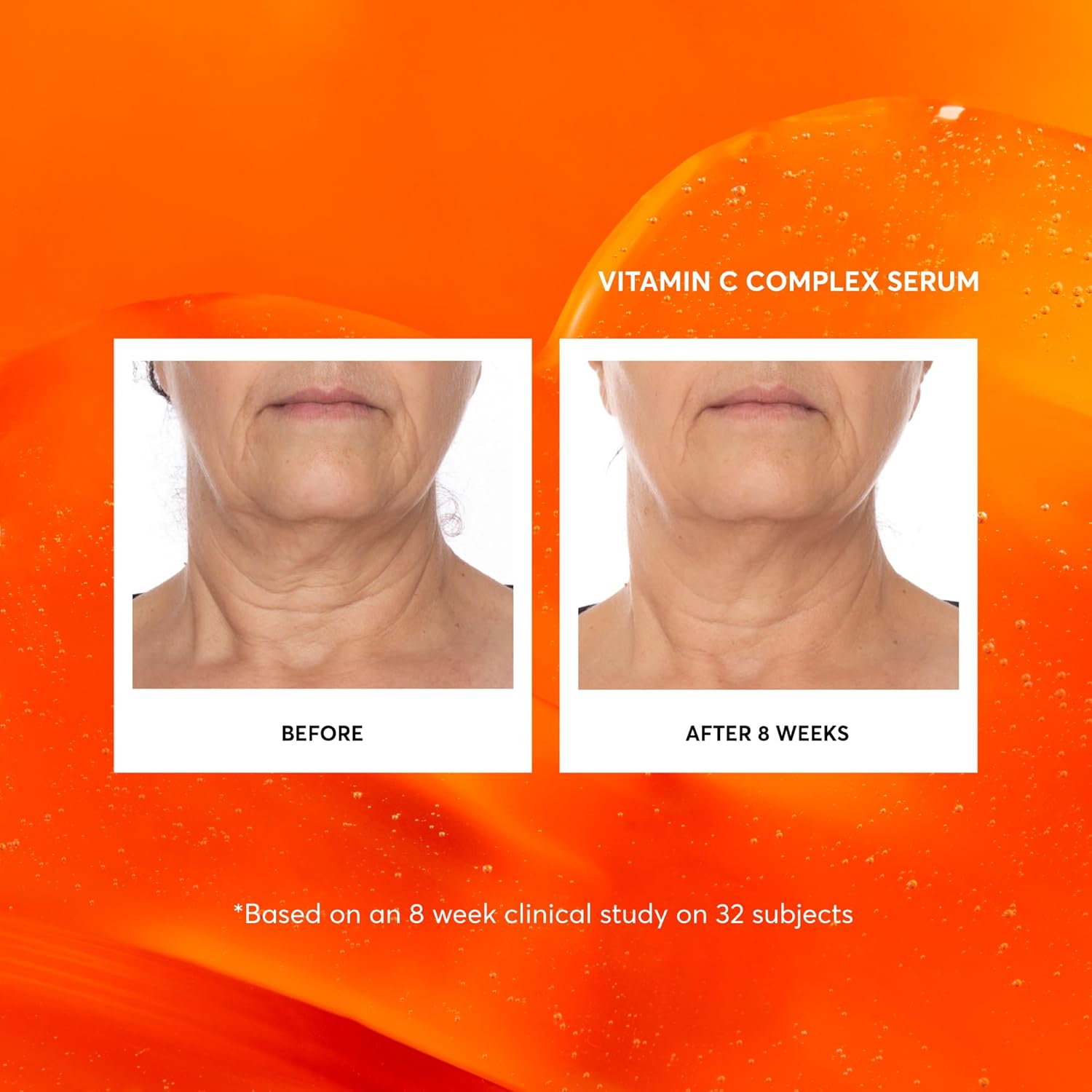 Naturium Vitamin C Complex Face Serum, Anti-Aging Facial Treatment with Hyaluronic Acid & Vitamin E, 1 oz - Image 3