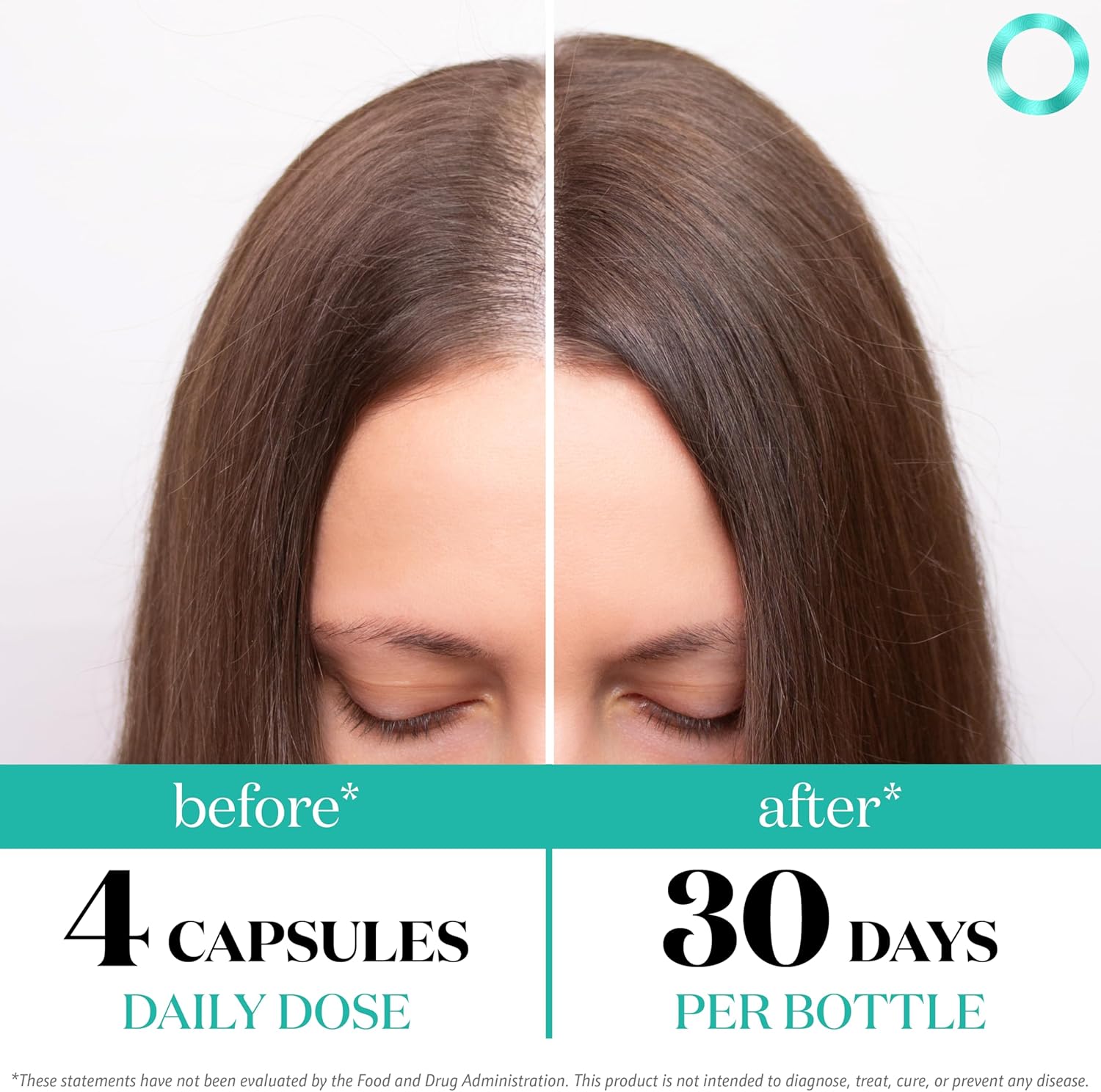 Women's Balance Hair Growth Supplements, Ages 45 and Up, Customer Proven for Visibly Thicker Hair and Scalp Coverage, Soy-Free, Made with 26 Ingredients including Beta Carotenes - 2 Month Supply - Image 3