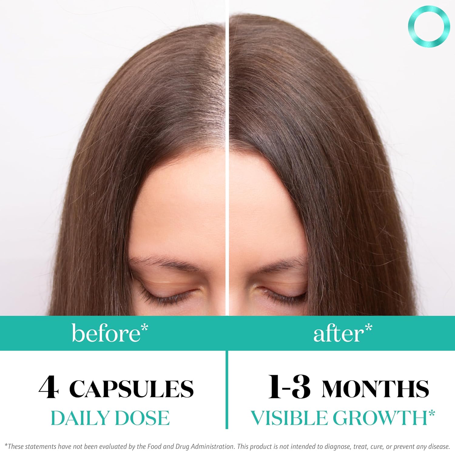 Women's Balance Hair Growth Supplements, Ages 45 and Up, Customer Proven for Visibly Thicker Hair and Scalp Coverage, Soy-Free, Made with 26 Ingredients Including Beta Carotenes - 1 Month Supply - Image 3