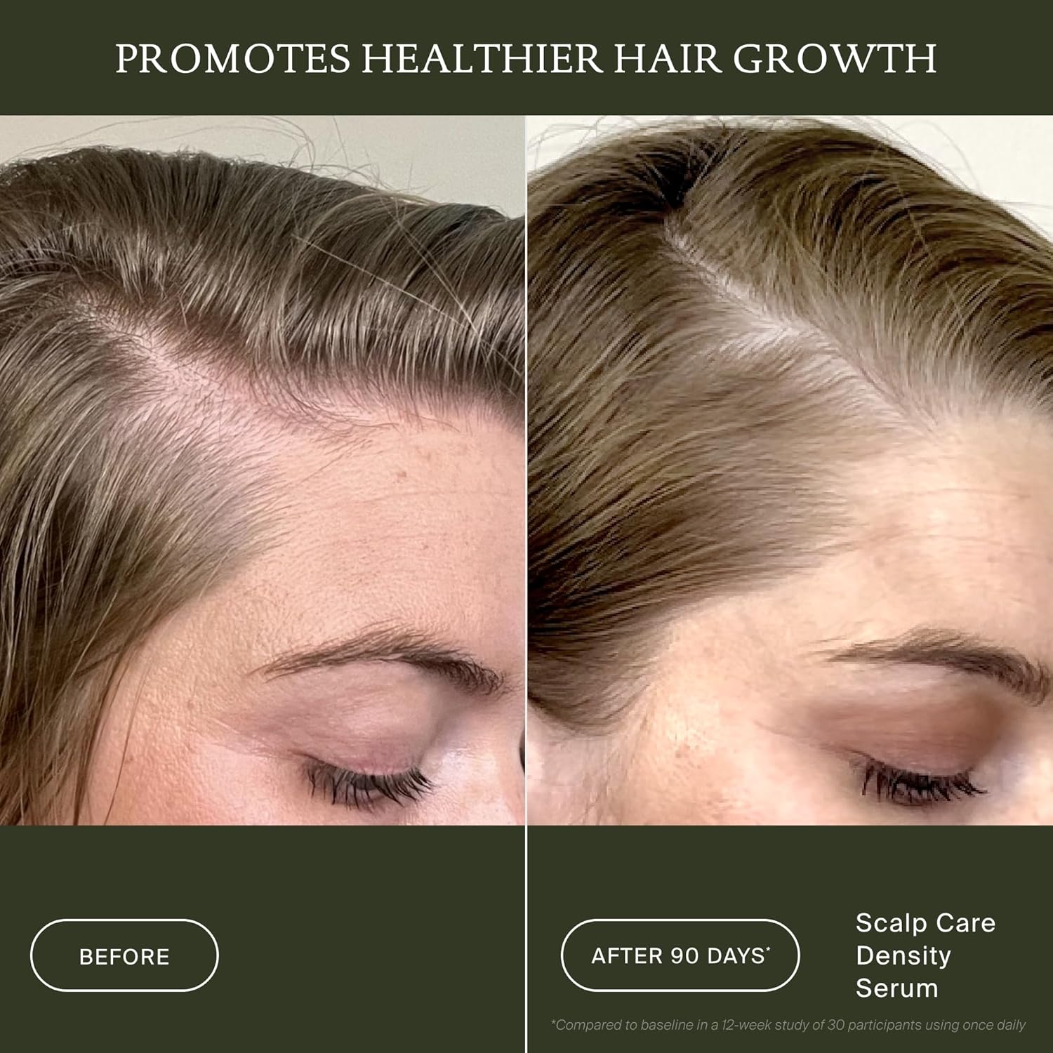 Living Proof Scalp Care Density Serum - Image 3