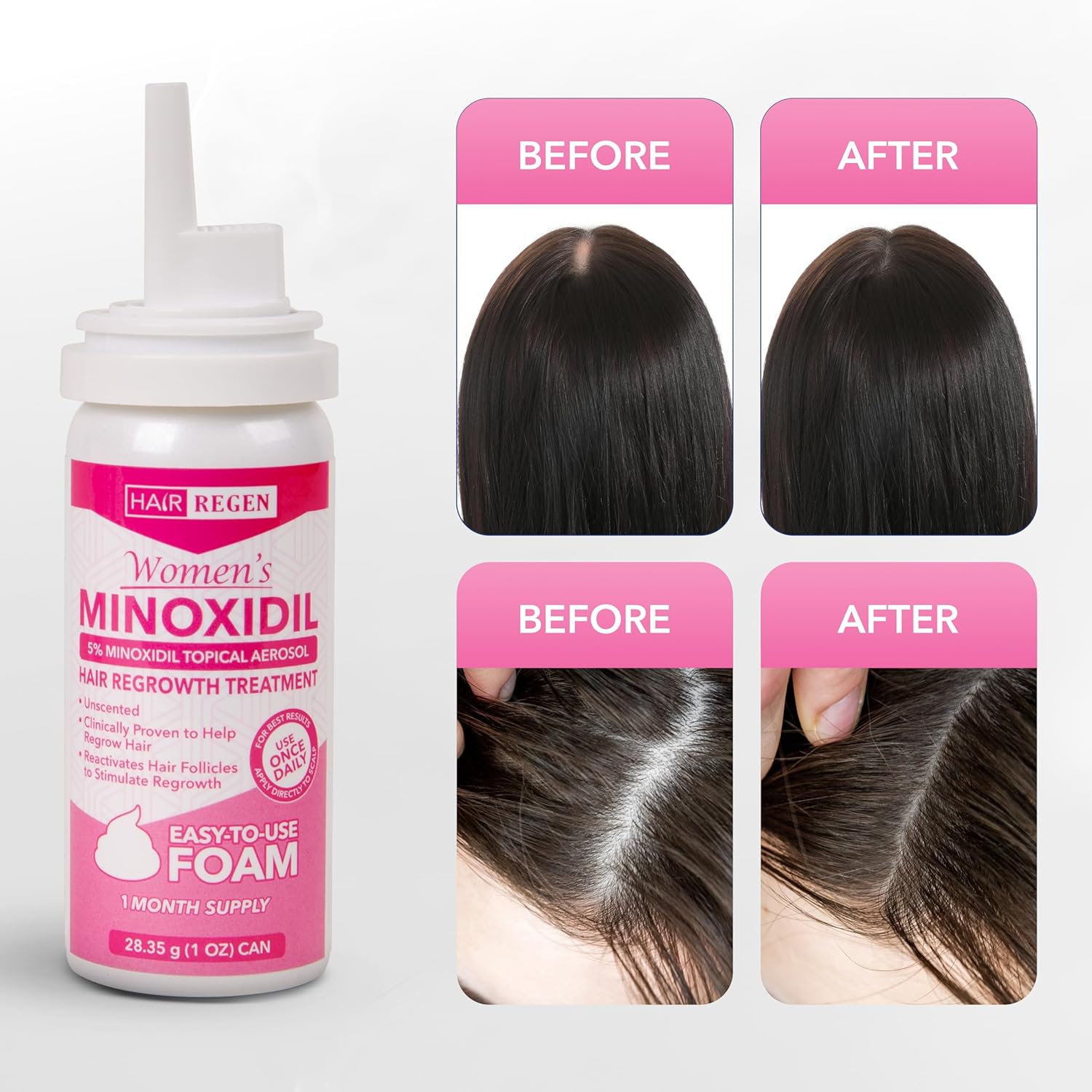 Hair Regen Minoxidil Foam for Women 5% Percent - Women's Hair Growth Treatment for Her - Topical Foaming Minoxidil for Women - Great for Hair Regrowth and Reduce Hair Loss - 1 Pack as 1 Month Supply - Image 9