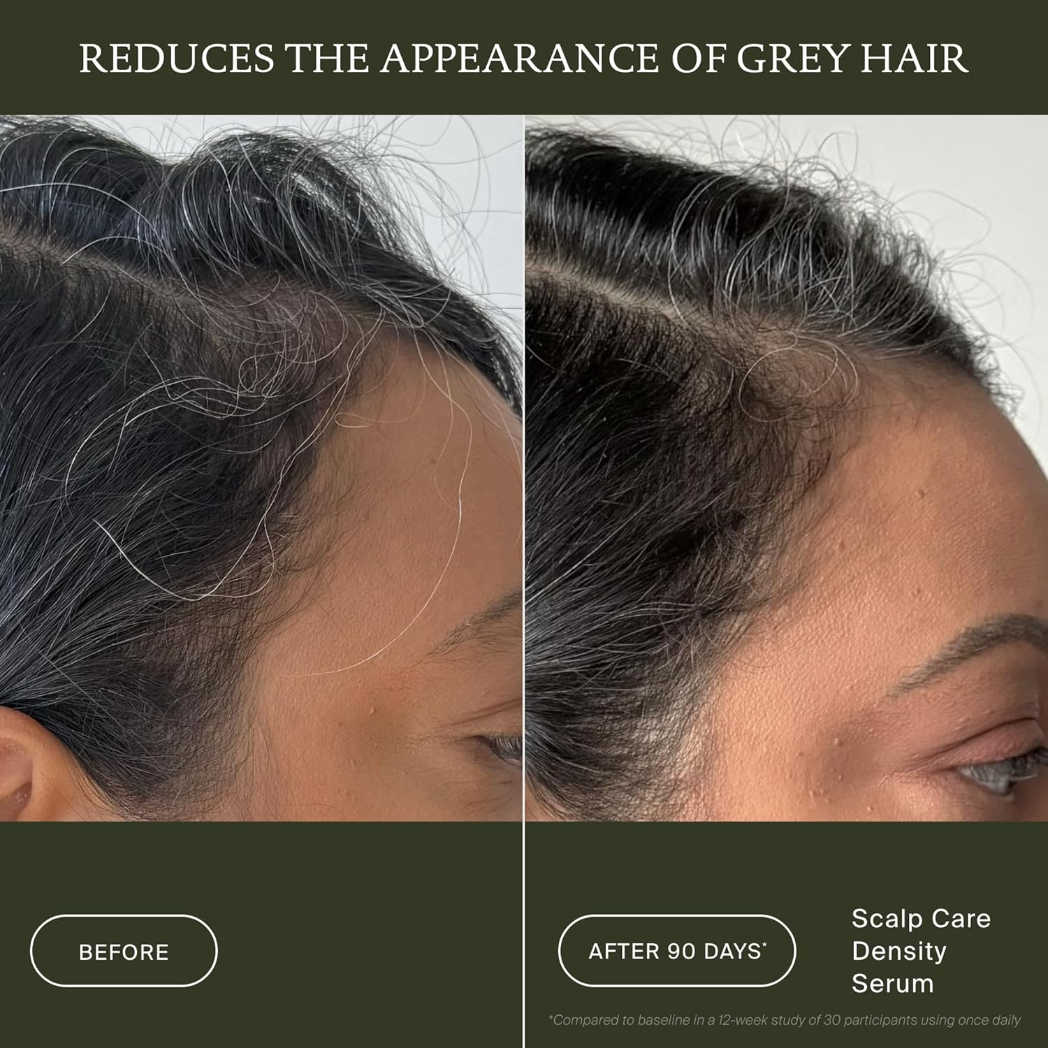 Living Proof Scalp Care Density Serum - Image 4