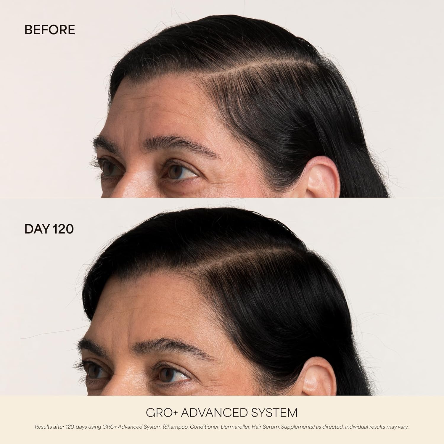 VEGAMOUR GRO+ Advanced Gel-Serum Cooling Massage Pen for Hair Density, Reduces Shedding and Promotes a Healthy Scalp, Helps with Severe Signs of Thinning, Vegan, Cruelty-Free - Image 3