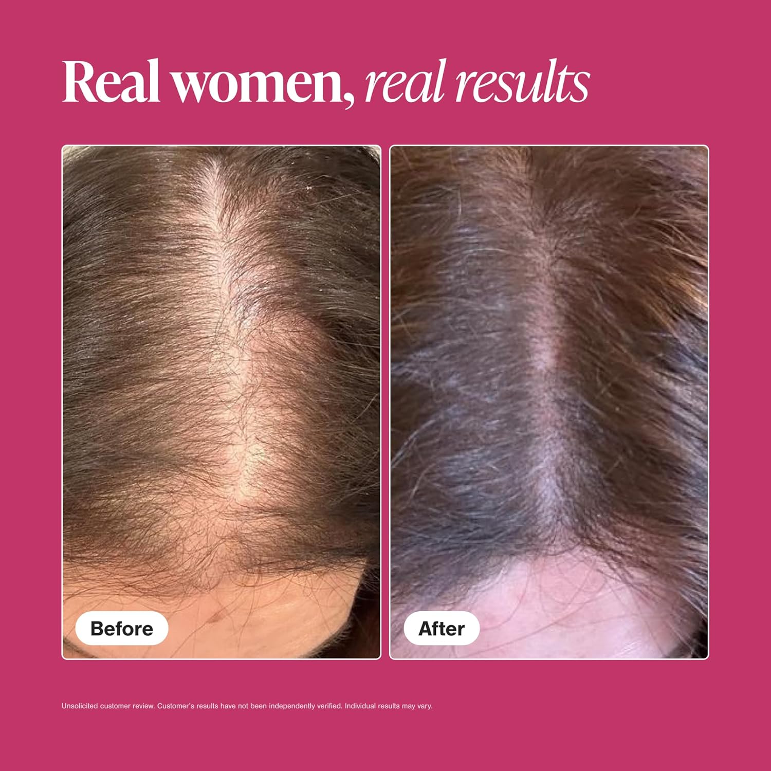 Viviscal Hair Growth Supplements for Women, Thicker Fuller Hair Support for Thinning Hair and Hair Loss, with Biotin and Marine Collagen, Drug-Free, 180 Tablets, 90-Day Supply - Image 6