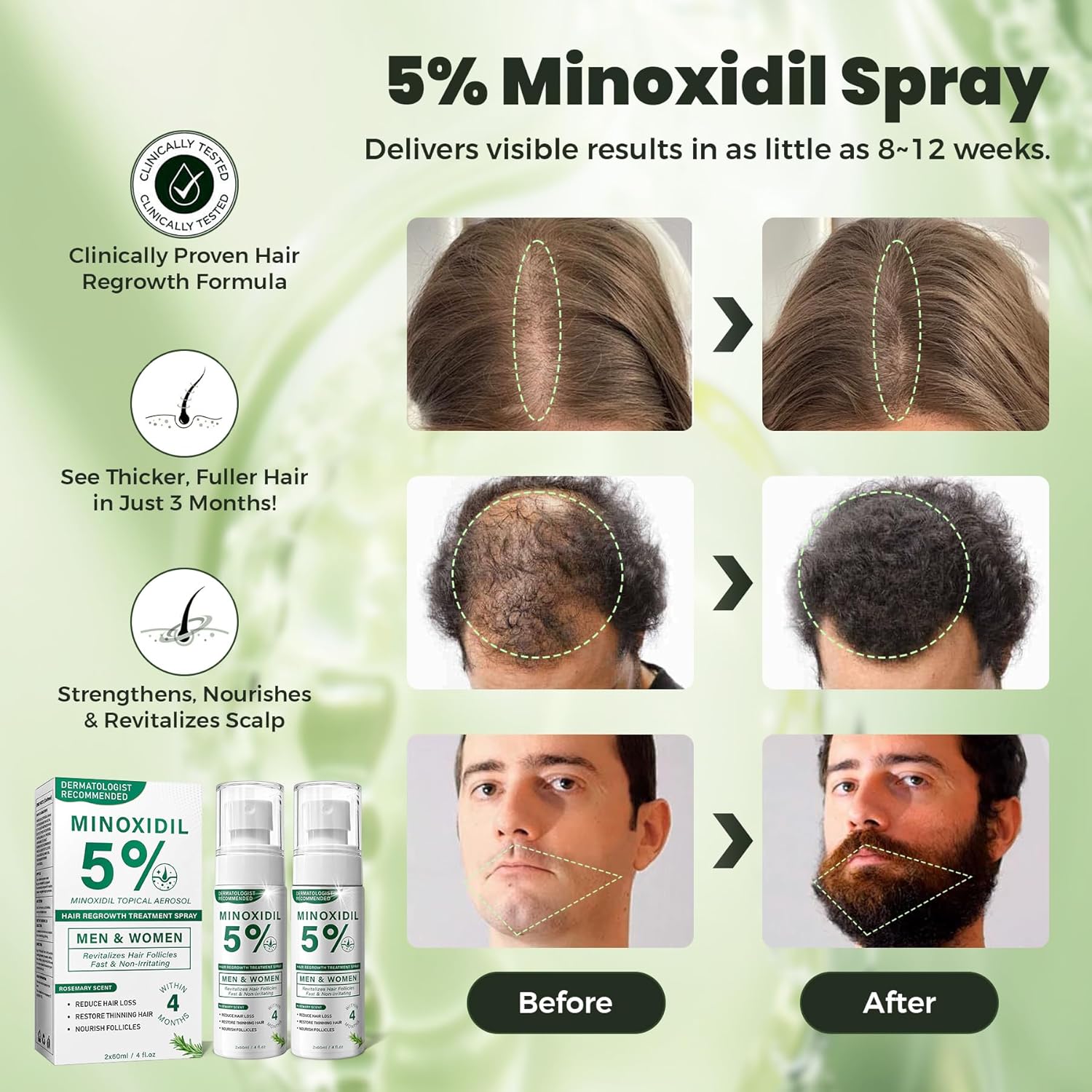 5% Minoxidil Hair Regrowth Spray for Men and Women with Rosemary Scent – 2 x 60ml Value Pack for 4+ Months – Lightweight Non Greasy Mist for Thinning Hair Receding Hairline Crown Support (Rosemary) - Image 3