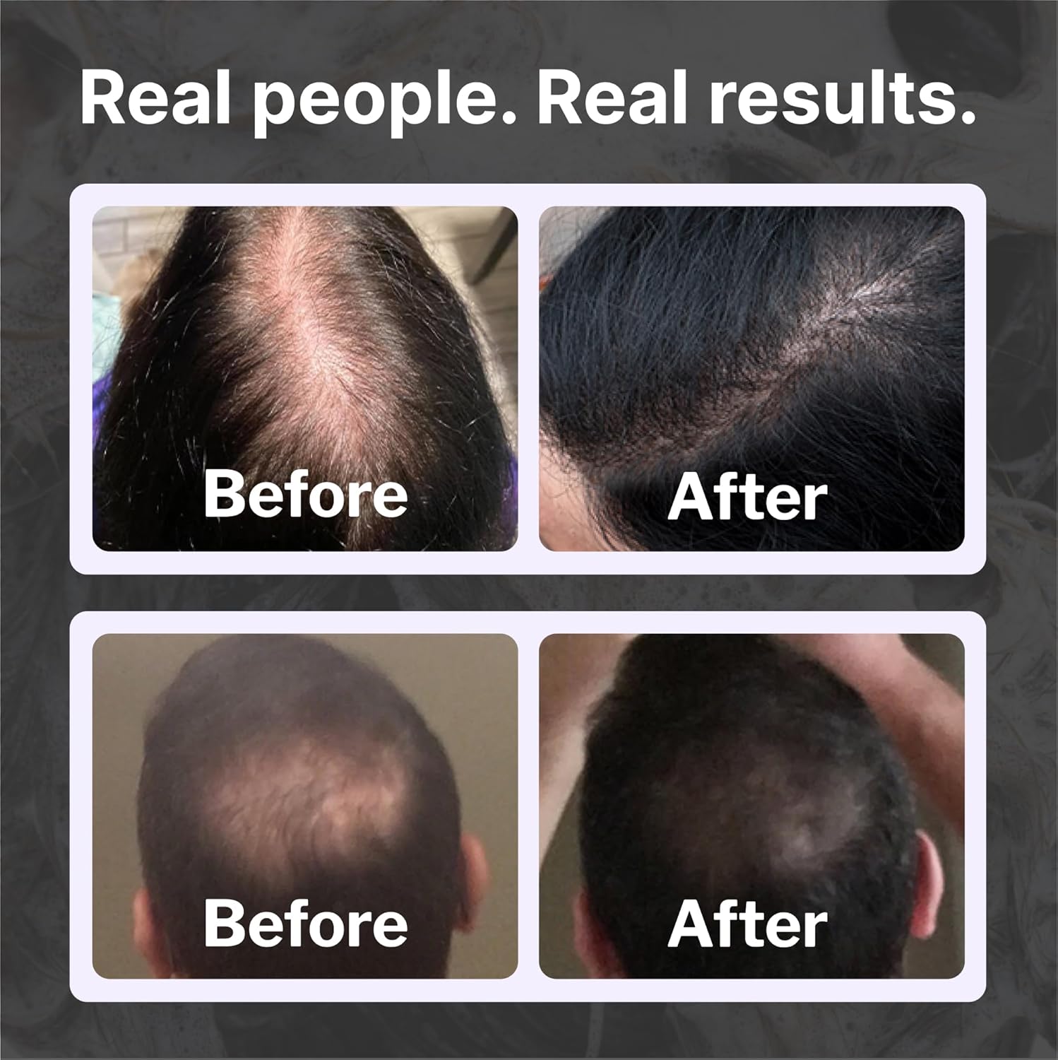 Shapiro MD Hair Growth Experts Hair Loss Shampoo | DHT Fighting Vegan Formula for Thinning Hair Developed by Dermatologists | Experience Healthier, Fuller and Thicker Looking Hair | 1 Month Supply - Image 4