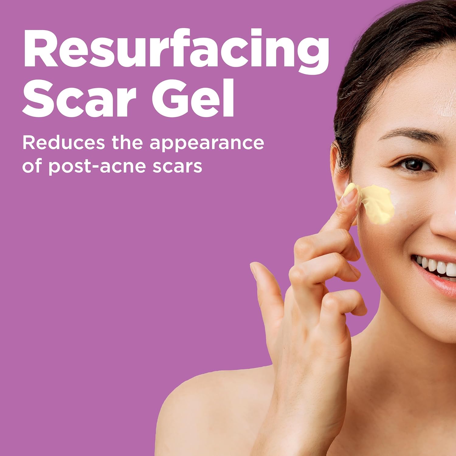 Differin Gel Acne Scar Spot Treatment for Face, Resurfacing Scar Gel, Gentle Skin Care for Acne Prone Sensitive Skin, 1 Oz (Packaging May Vary) - Image 2