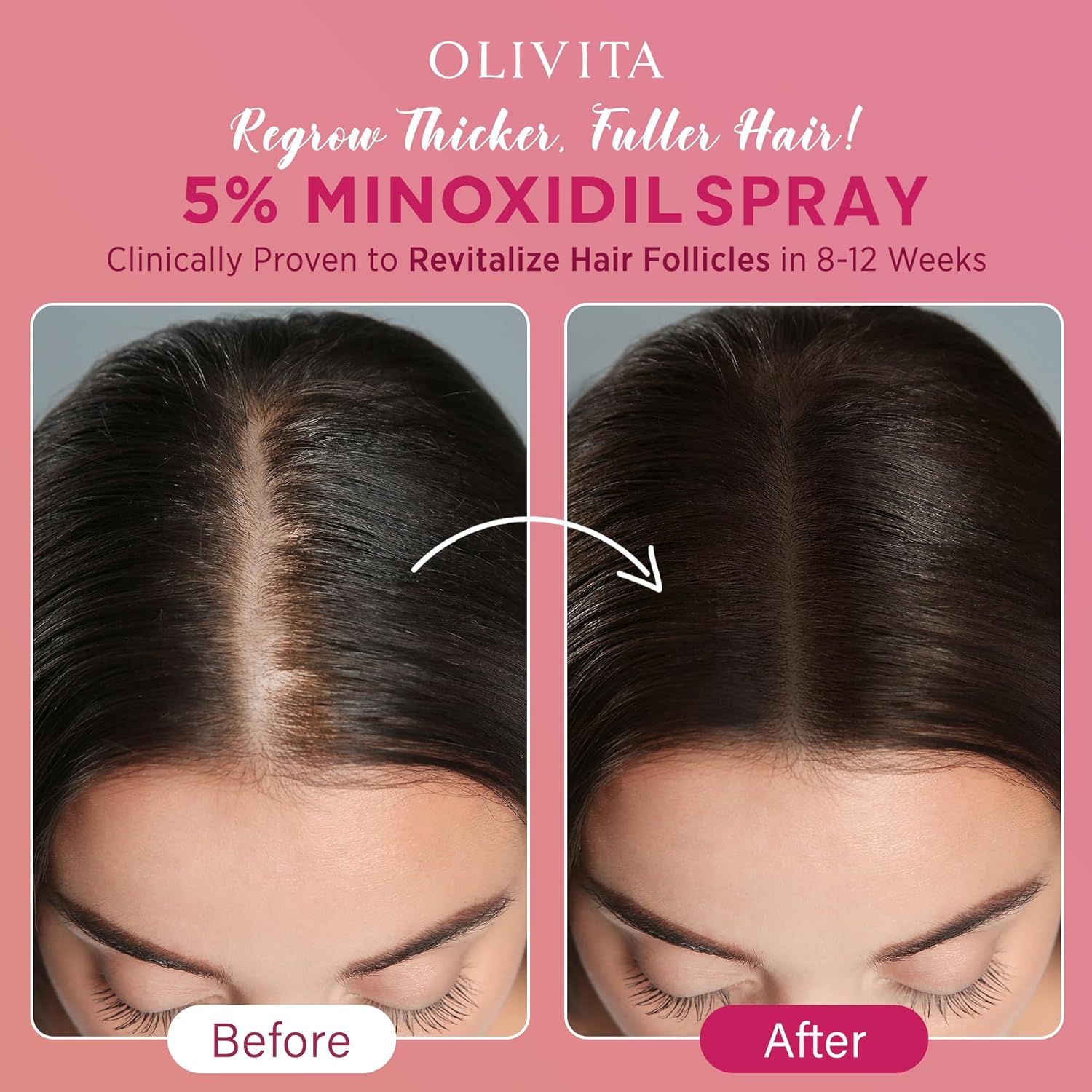 5% Minoxidil Spray for Women Hair Growth: Extra Strength Hair Regrowth Treatment – Revitalize Hair Follicles & Regrow Thicker, Fuller Hair – Hair Loss Solution - 2 Packs - Image 4