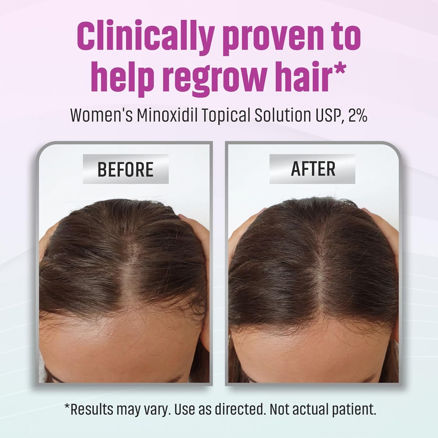 Minoxidil Women's 2% Solution Tincture Bottle, Clinically Proven To Regrow Hair, Topical Solution 2%, Hair Thinning Treatment (2 Fl Oz (Pack of 1)) - Image 3