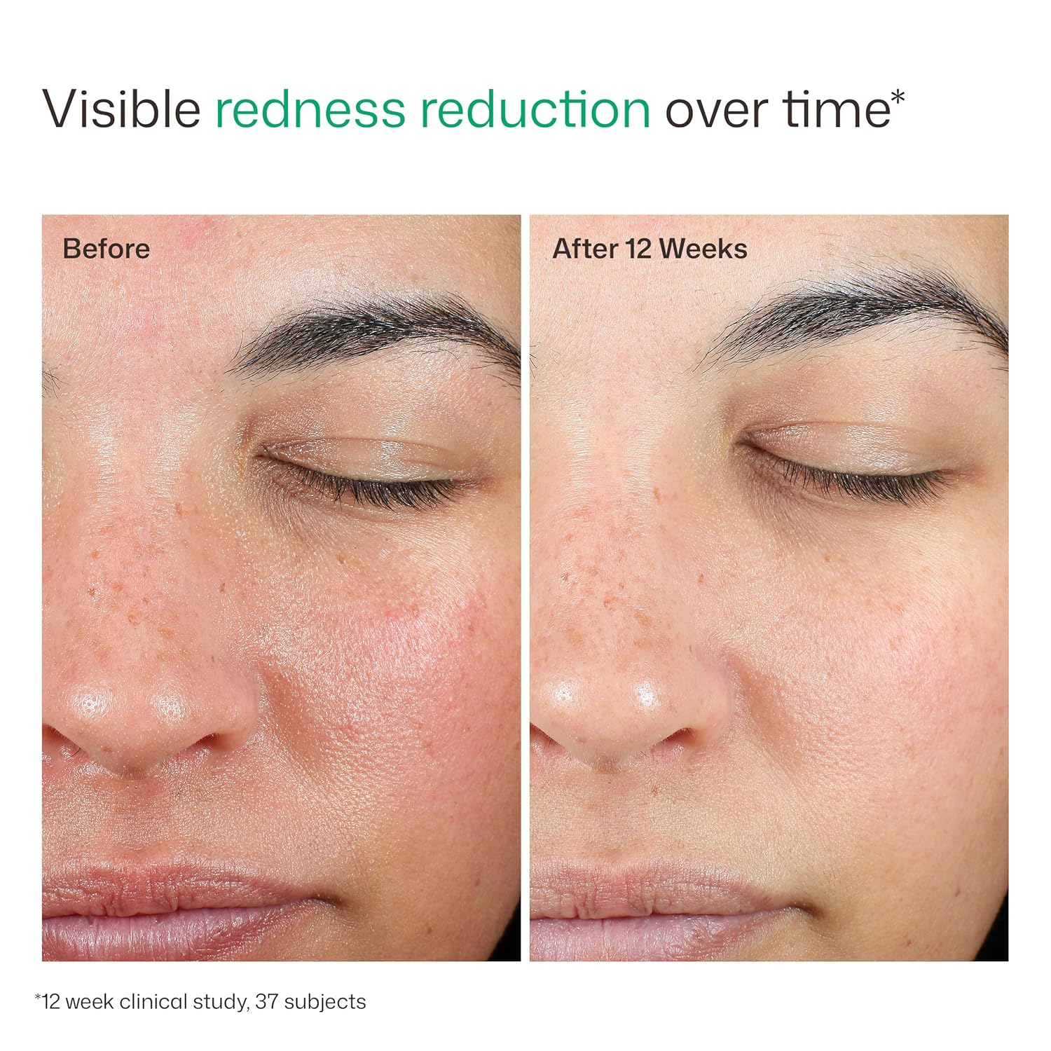EltaMD UV Skin Recovery Face Sunscreen with Zinc Oxide, All Mineral, Safe for Sensitive Skin SPF 50 - Image 8