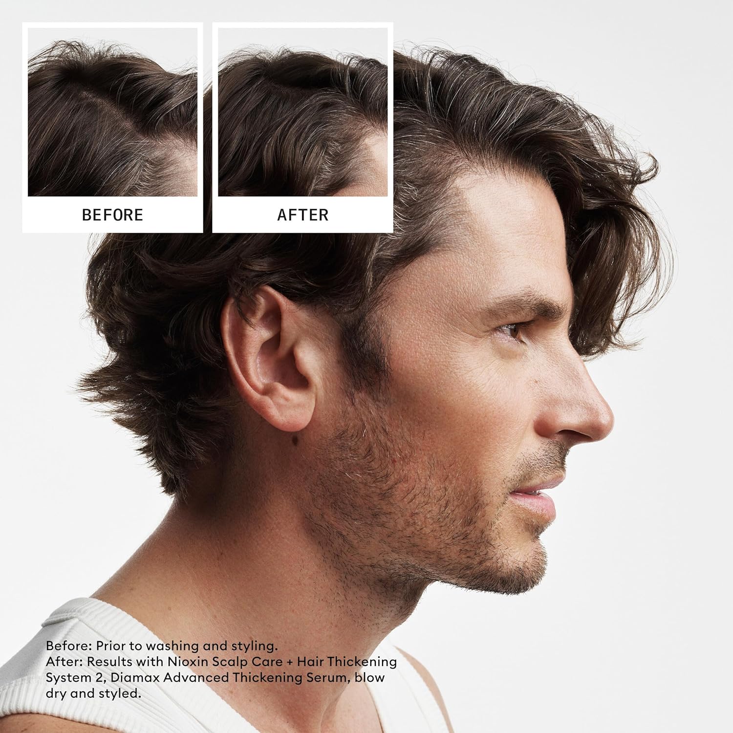 Nioxin System 2 Scalp + Hair Thickening Shampoo for Natural Hair with Progressed Thinning | Cleanse & Boost Hair Density with Niacinamide & Biotin - Image 2