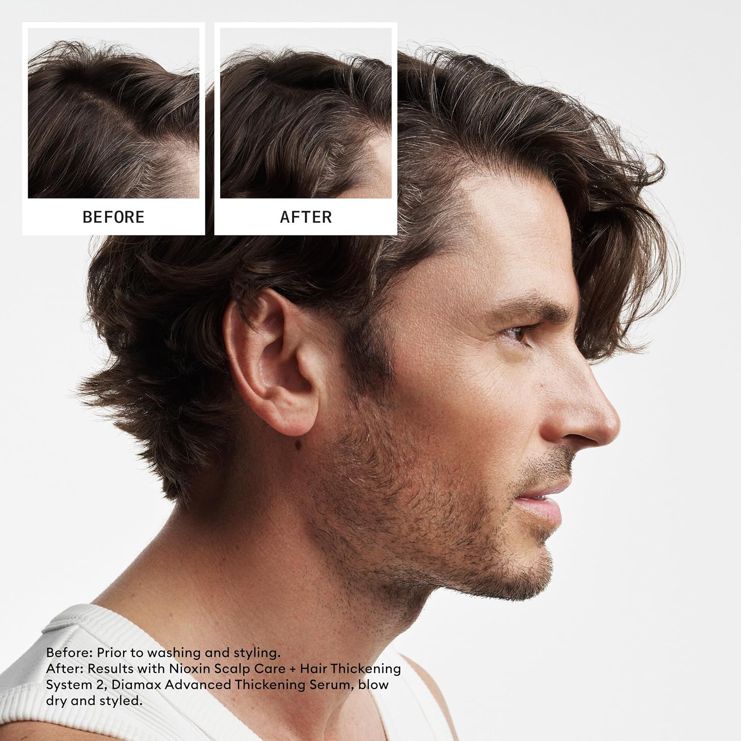 Nioxin Shampoo & Conditioner Liter Duo Sets | Prepacks with Pumps Included | Systems 1-4 | For Natural, Colored, & Damaged Hair with Light to Progressed Thinning | Strengthen & Boost Hair Density - Image 3