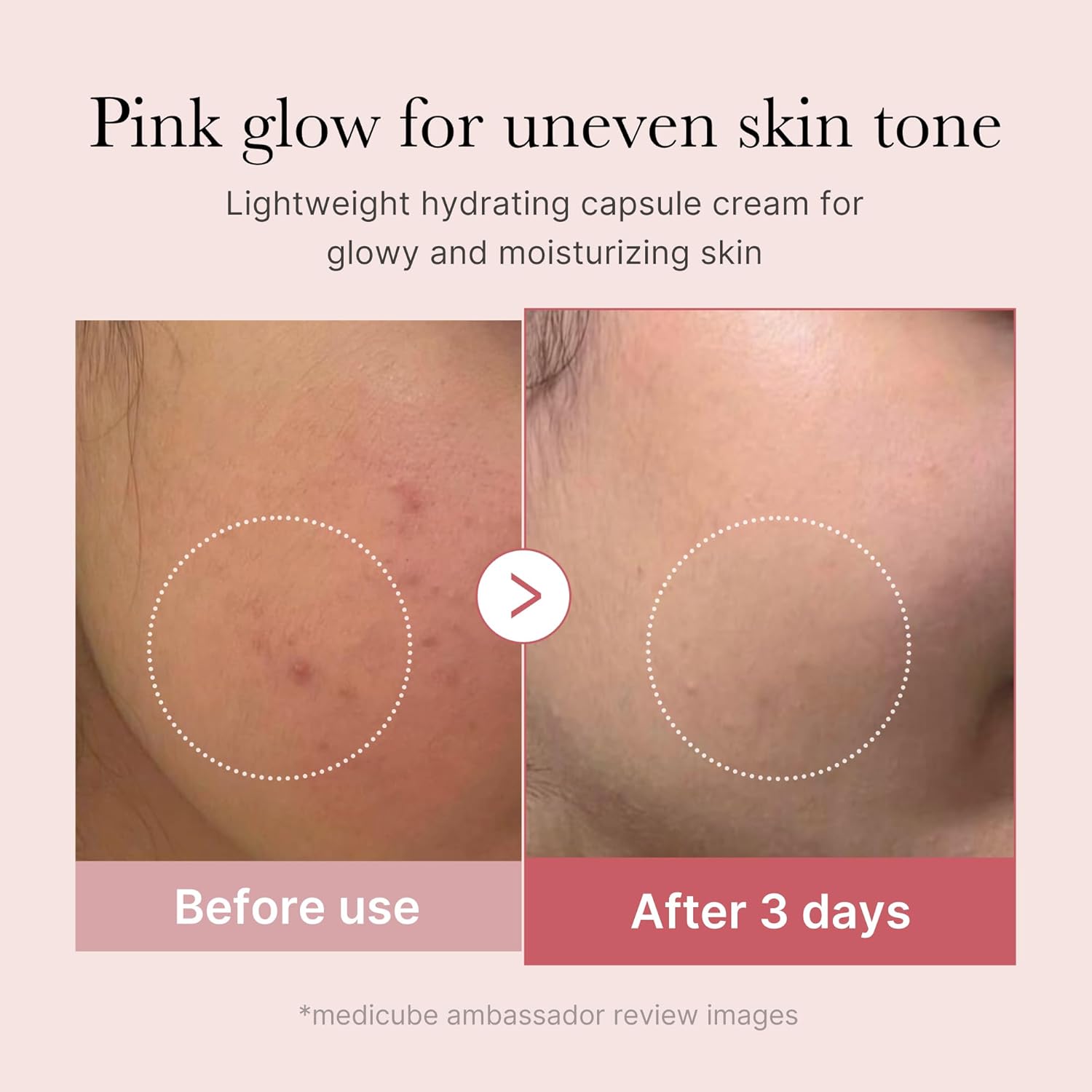 medicube Uneven Skin & Firm Duo: Deep Vitamin C Golden Capsule Face Moisturizer and Salmon DNA PDRN Pink Collagen Capsule Cream - Image 4
