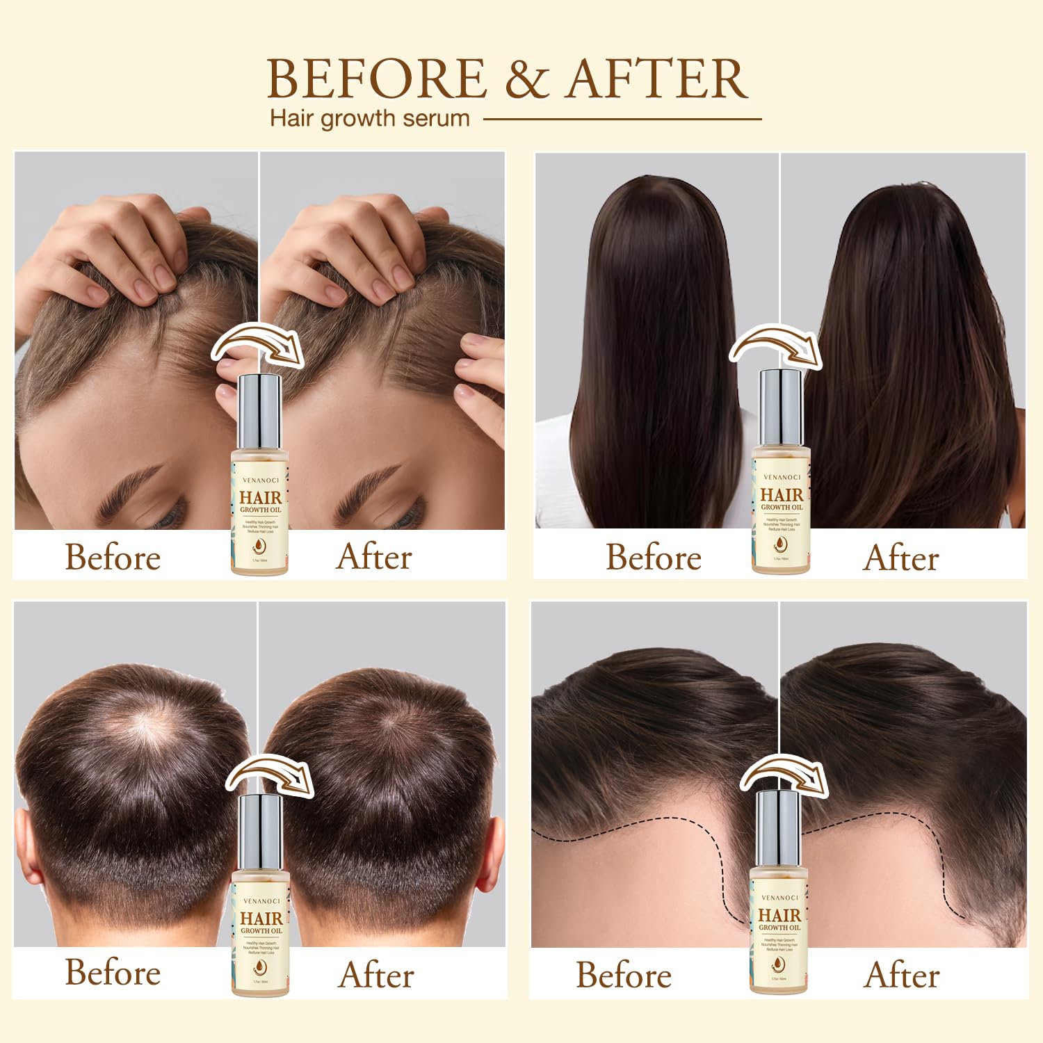 Hair Growth Oil with Rosemary & Biotin: Natural Hair Regrowth Serum for Women & Men – Anti Hair Loss & Thinning Treatment – Promotes Thicker, Fuller, Stronger, Healthier Hair – All Hair Types - Image 2