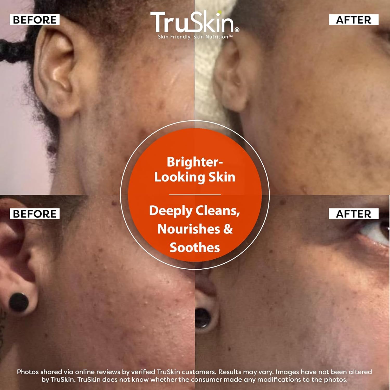 TruSkin Vitamin C Face Wash Cleanser - Brightening Facial Cleanser with Vitamins C & E, Rosehip Oil, Aloe Vera & MSM - Gently Cleanses, Refreshes & Supports Radiant Skin - 4 fl oz - Image 5