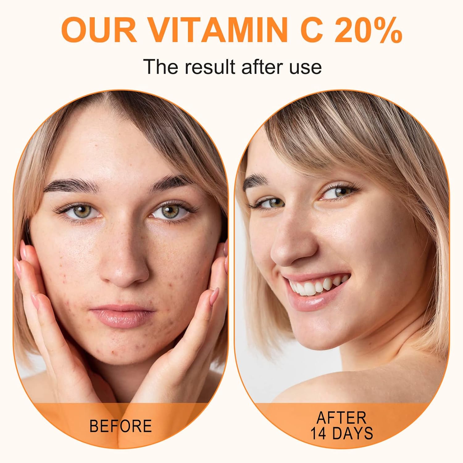 Premium 20% Vitamin C Serum For Face with Hyaluronic Acid, Retinol & Amino Acids - Boost Skin Collagen,Hydrate & Plump Skin, Anti Aging & Wrinkle Facial Serum 60ml - Image 5