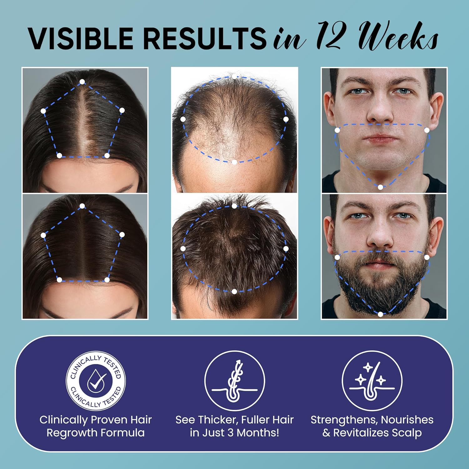5% Minoxidil for Men and Women Hair Growth: Minoxidil Spray Hair Regrowth Treatment Serum with Biotin & Rosemary -Stop Hair Thinning and Hair Loss For Stronger Thicker Longer Hair 2 Pack - Image 3