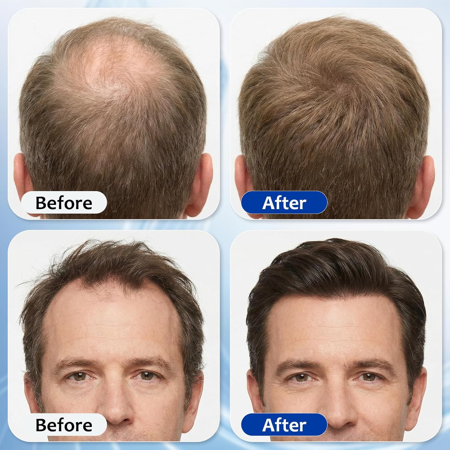 Hair Growth Serum Roll On with 3% Rosemary,3% Batana Oil,2% Pea Extract,2% Ginger Root Oil,Stronger Root,stimulate follicle,Hair Thicker,Hair Loss Treatment,Hair Growth Serum(30ML/1.01FL.OZ) - Image 5